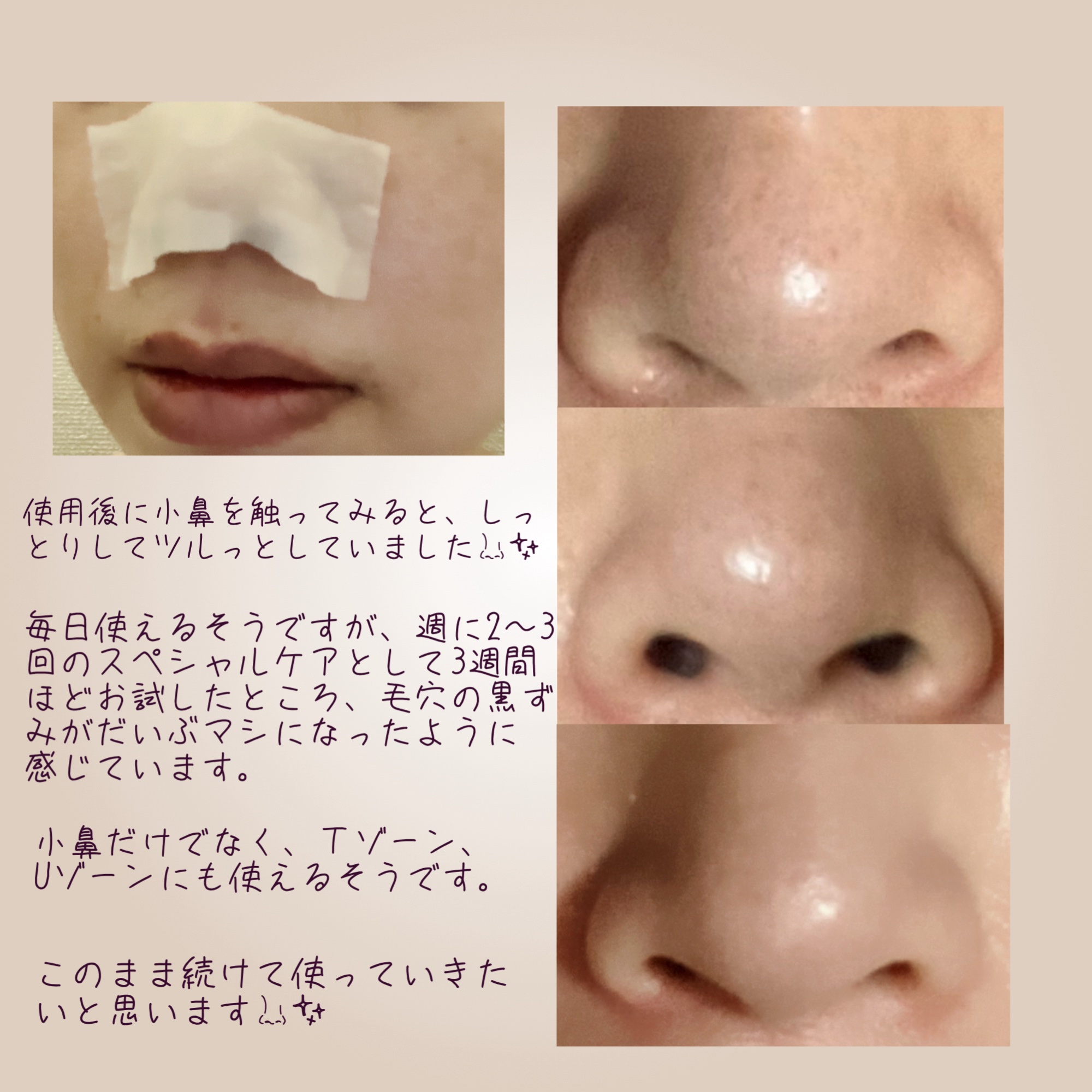 ノーモアブラックヘッド(ノーズピーリング)/One-day's you/スクラブ・ゴマージュを使ったクチコミ（3枚目）