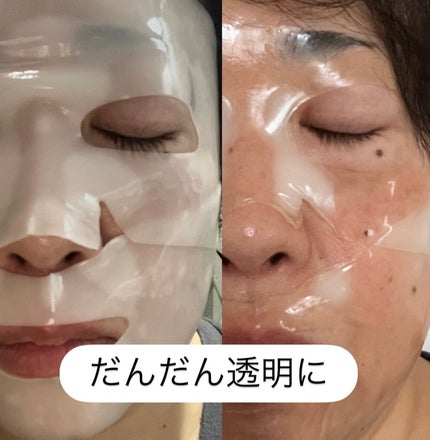 PDRNコラーゲンゲルマスク/BANOBAGI/シートマスク・パックを使ったクチコミ(7枚目)