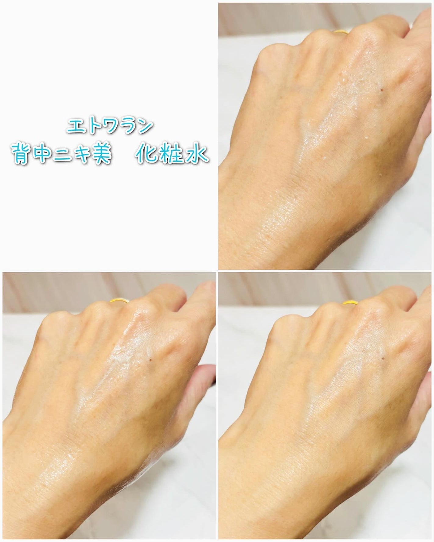 saya on LIPS 「エトワラン背中ニキ美 化粧水100ml気になる背中やボディのニ..」(3枚目)