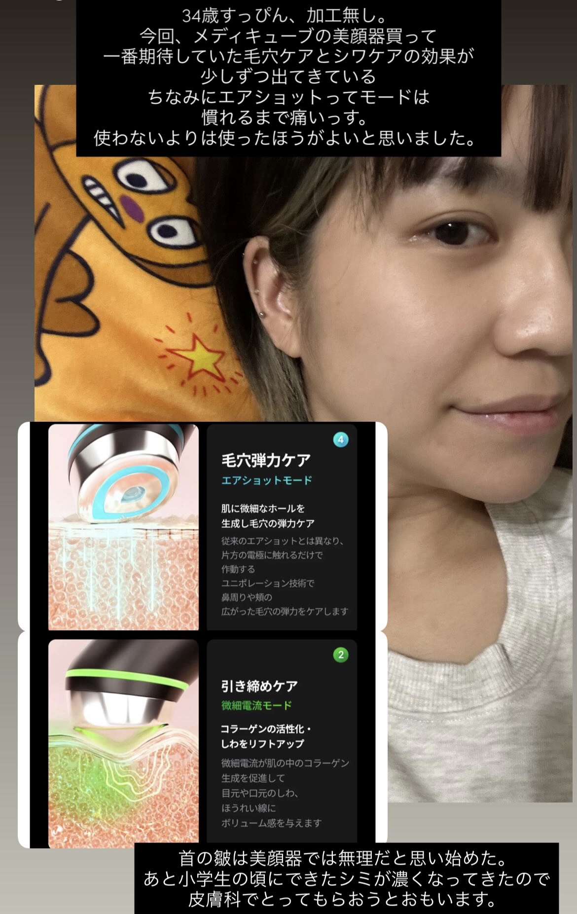 AGE-R ブースタープロ/MEDICUBE/美顔器・マッサージを使ったクチコミ（1枚目）