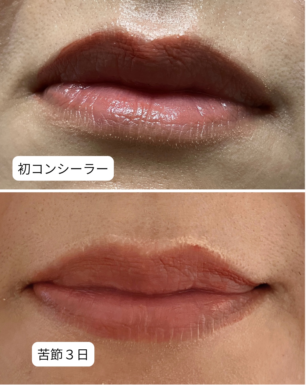 【記録用】

コンシーラーを口紅の前に塗ると、
みんなみたいにかわいい口元になれるよ〜と聞いて、
試行錯誤すること3日目に突入しました。

おはようございます☀️

この三日間、何度も「おば九」みたいな唇を量産し、
若干、口元が荒れてきて本