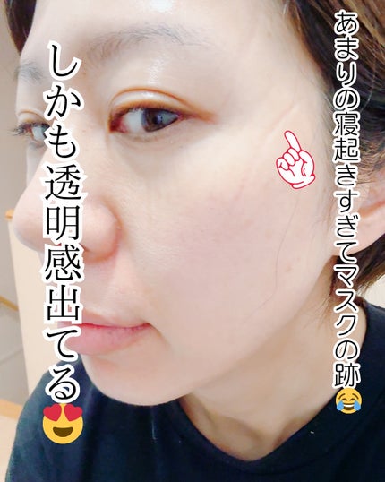 マデカソサイド カーミングマスク/Bluban/シートマスク・パックを使ったクチコミ(6枚目)