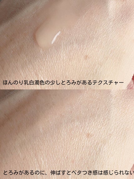 バイオスキンエッセンスプラス/Bionist (ビオニスト)/美容液を使ったクチコミ(4枚目)