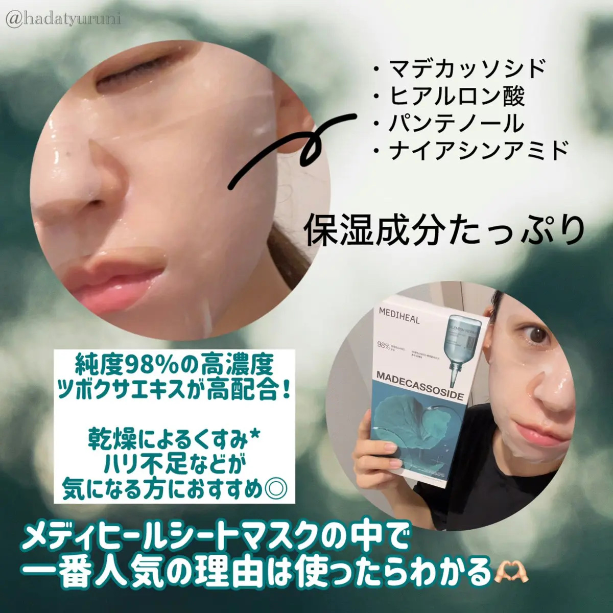 マデカッソシド エッセンシャルマスク/MEDIHEAL/シートマスク・パックを使ったクチコミ（3枚目）