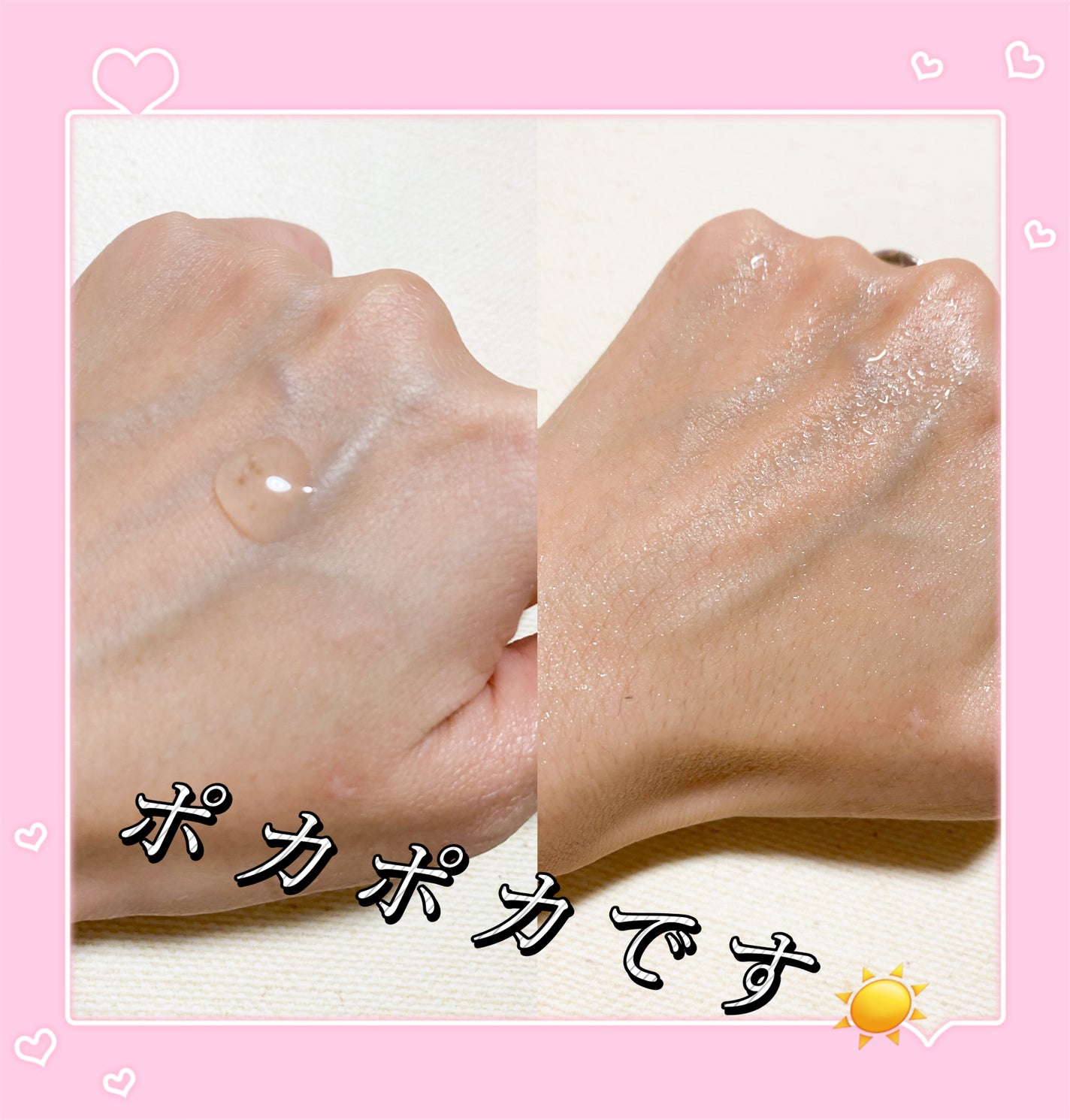 リペアジェル/リソウコーポレーション/美容液を使ったクチコミ(2枚目)