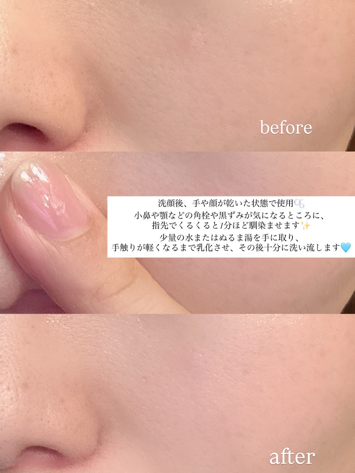 ポアクリアセラム/CHPT.9/美容液を使ったクチコミ（3枚目）