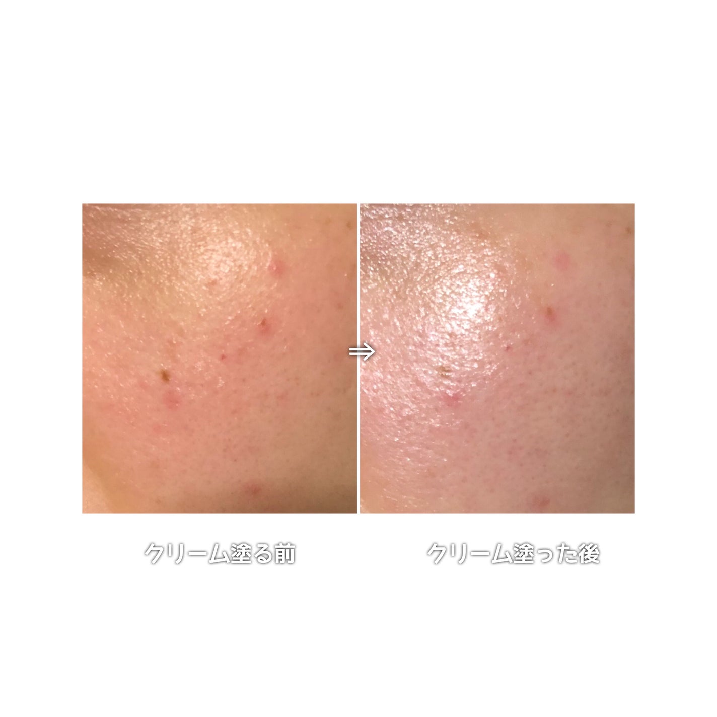 インテカ スージングクリーム/make prem/フェイスクリームを使ったクチコミ(6枚目)