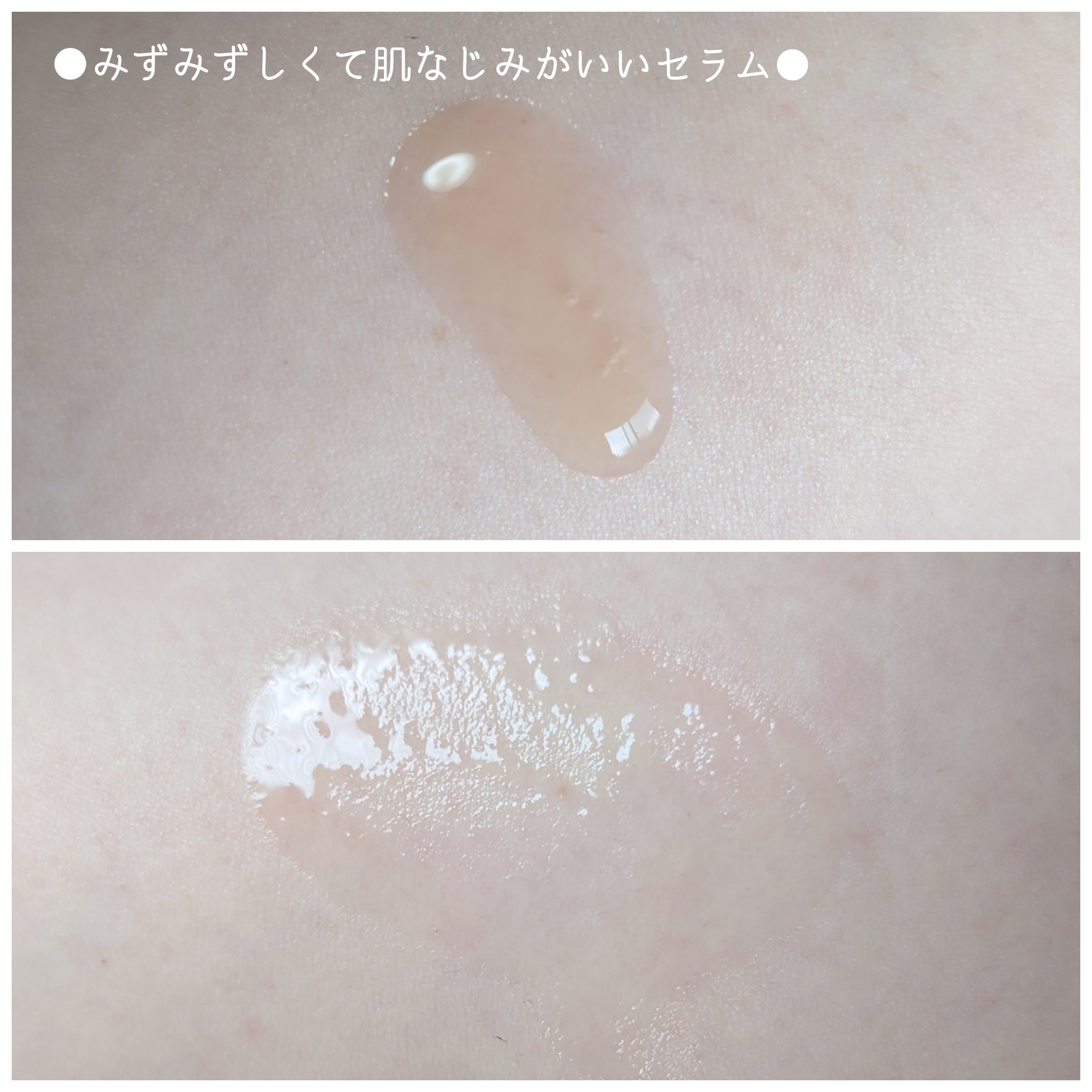 ビフィダバイオームコンプレックスセラム/manyo/美容液を使ったクチコミ（3枚目）