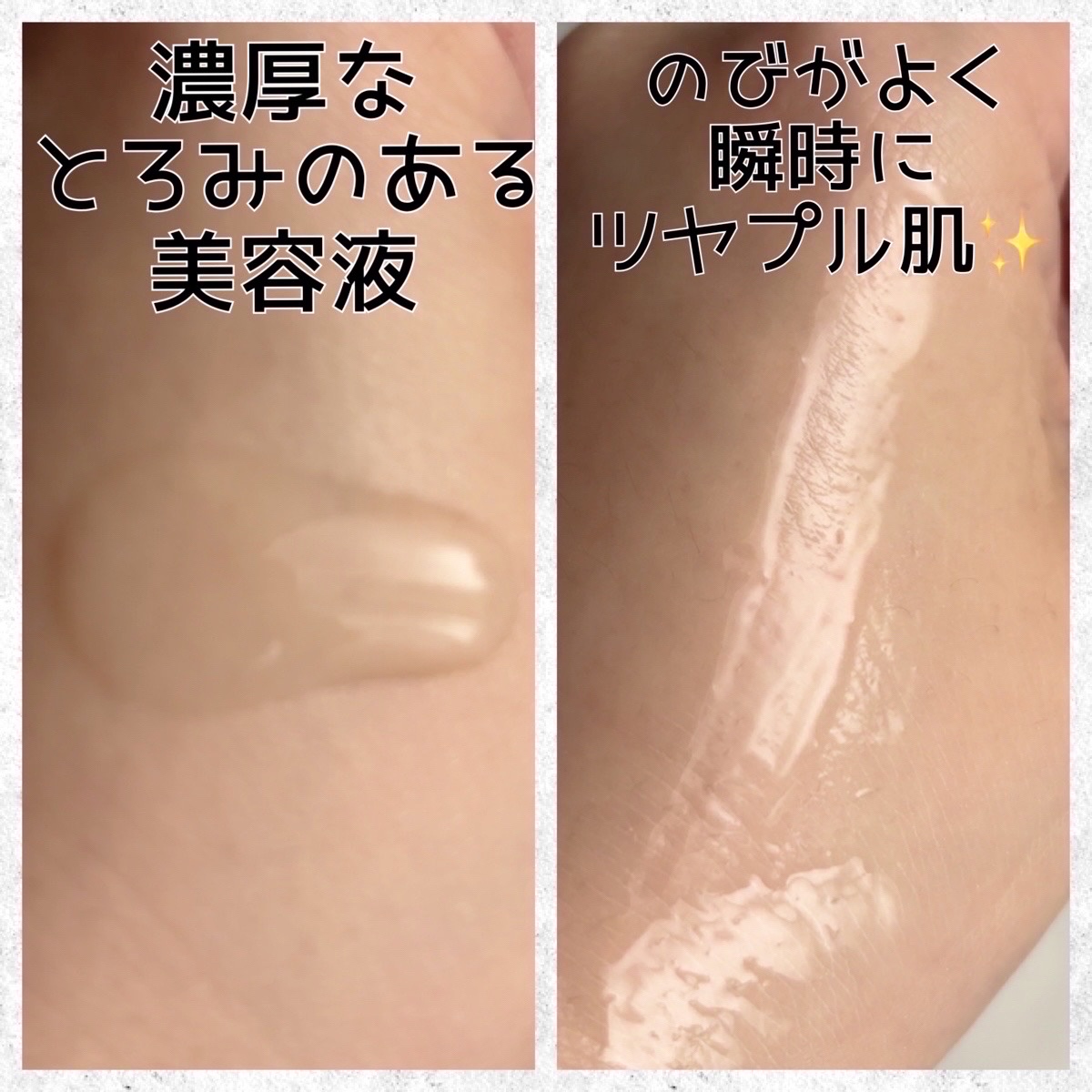 REJURAN デュアル エフェクト アンプル 30mL/REJURAN COSMETICS/美容液を使ったクチコミ（3枚目）