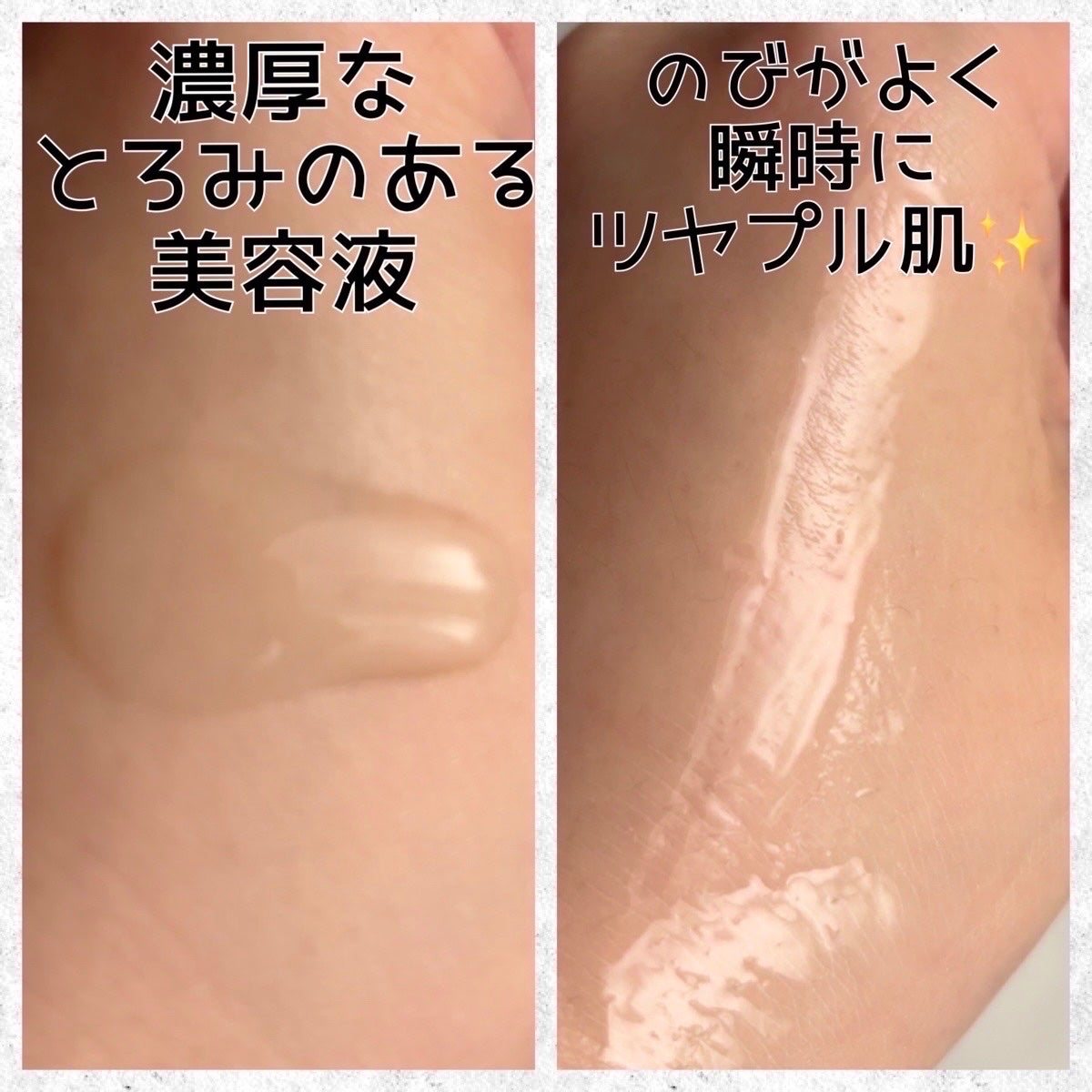 REJURAN デュアルエフェクトアンプル 30ml/REJURAN COSMETICS/美容液を使ったクチコミ(3枚目)