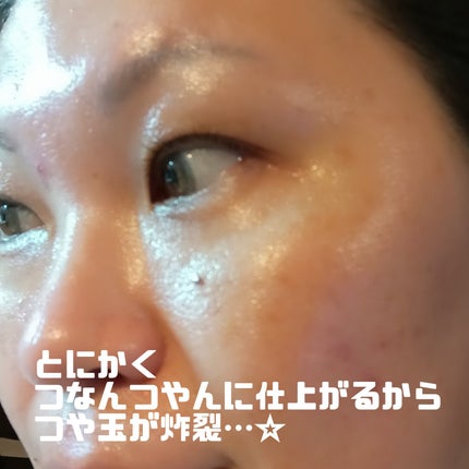 ビタ3セラム/オーズナリー/美容液を使ったクチコミ(5枚目)