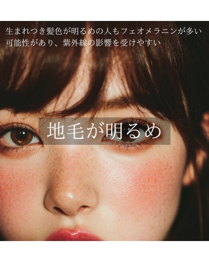 もぐお on LIPS 「そばかすができやすい人には共通した特徴がある?/そばかすのでき..」(5枚目)