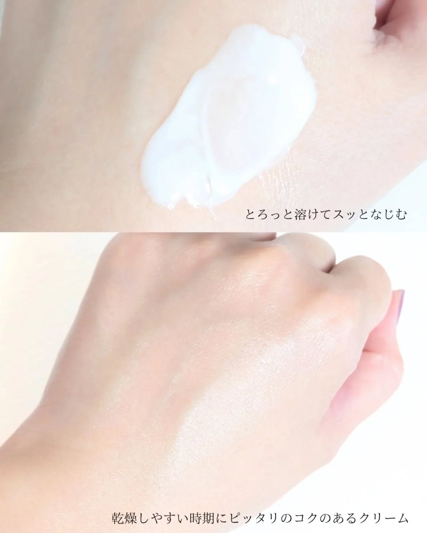 ありちゃん@フォロバ100🤍 on LIPS 「アルビオンさまからいただきました✨️@albion_jp\とろ..」(3枚目)