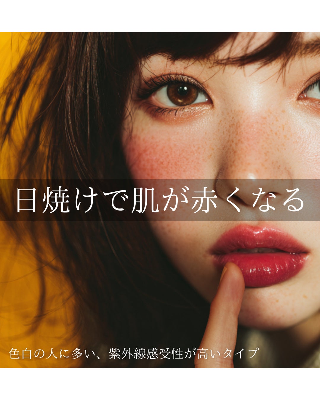 もぐお on LIPS 「そばかすができやすい人には共通した特徴がある?/そばかすのでき..」(7枚目)