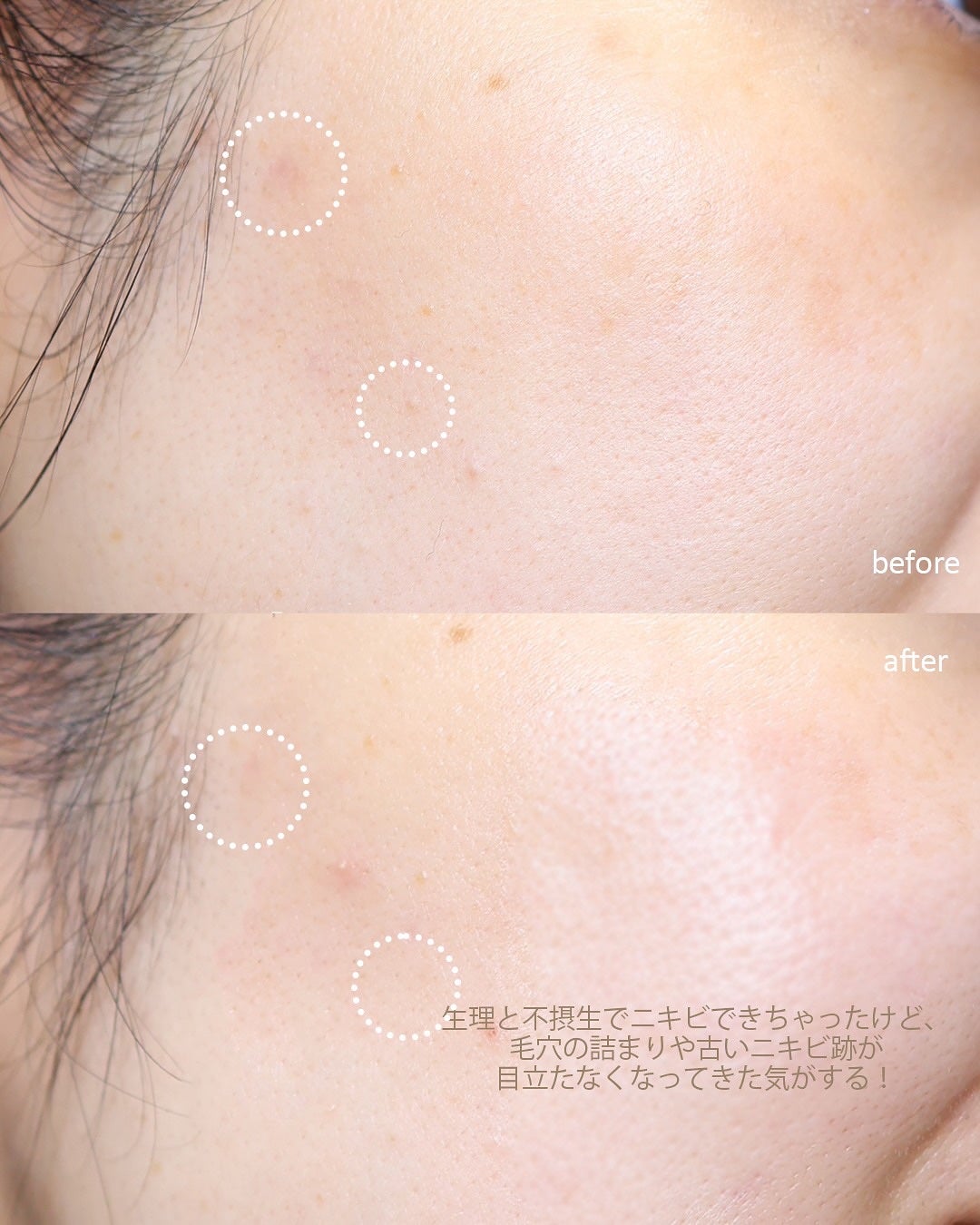 ダーマジェンシー ゼロカ81 セラム/DERMAGENCY/美容液を使ったクチコミ(4枚目)