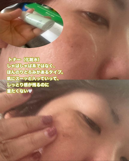 バランシング シカ ブレミッシュ トラベルキット/Roume/スキンケアキットを使ったクチコミ(3枚目)