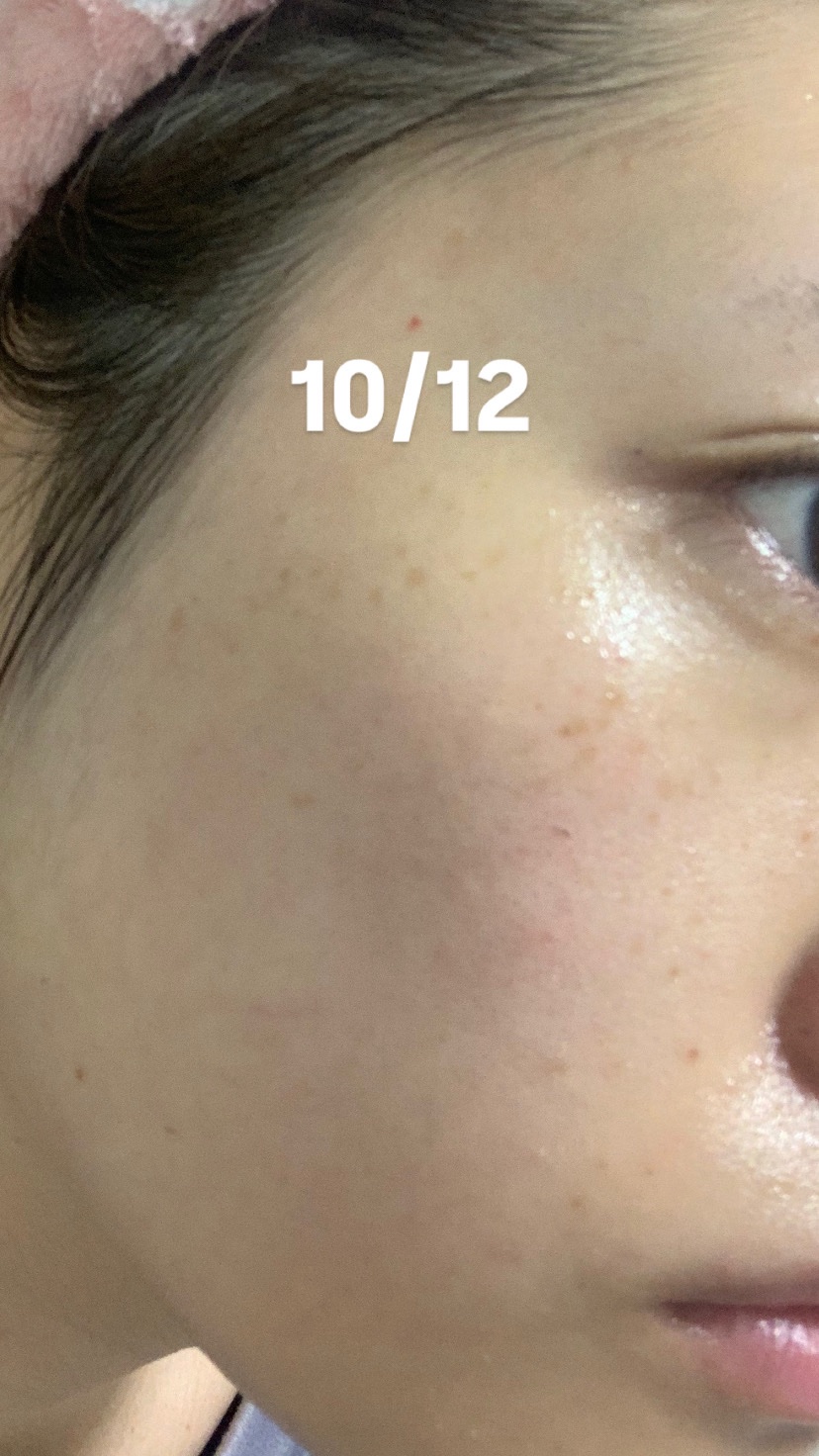 プラスGGベースセラム/プラスキレイ/美容液を使ったクチコミ（3枚目）