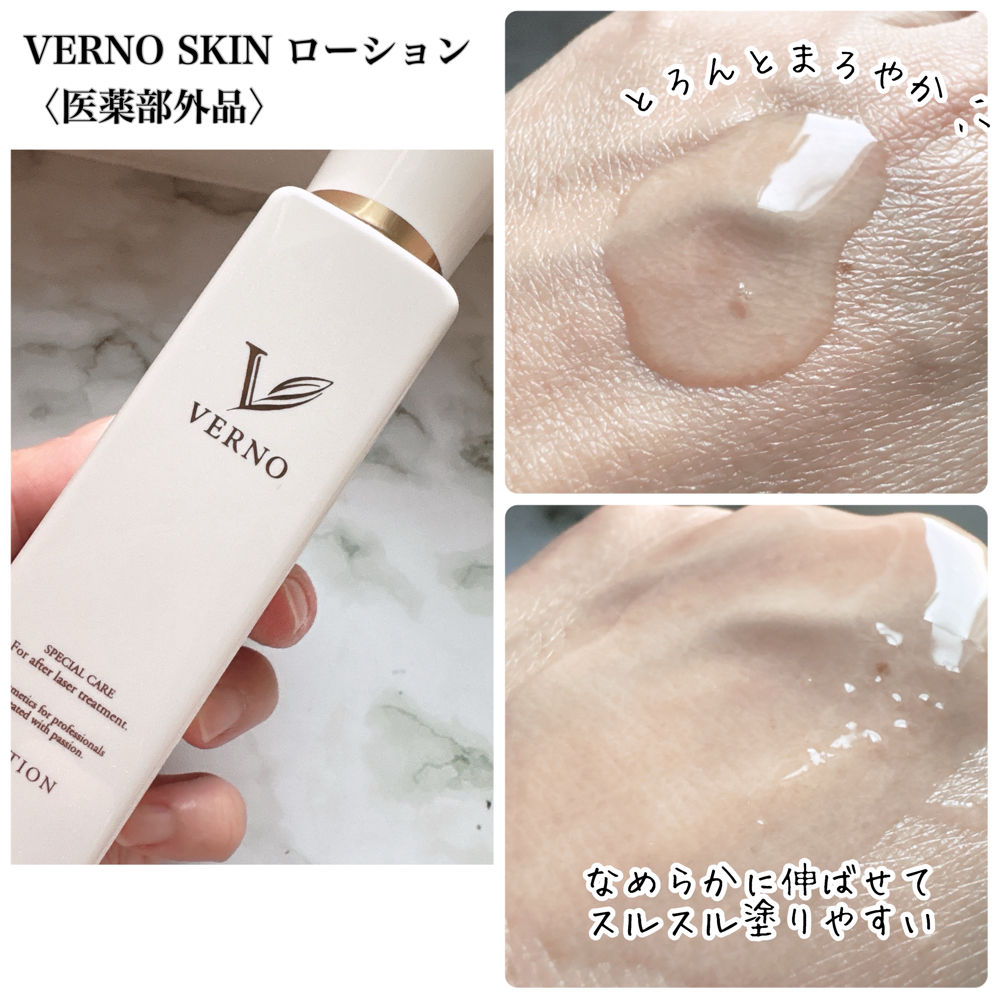 VERNO SKIN ローション〈医薬部外品〉/VERNO SKIN CARE/化粧水を使ったクチコミ（2枚目）