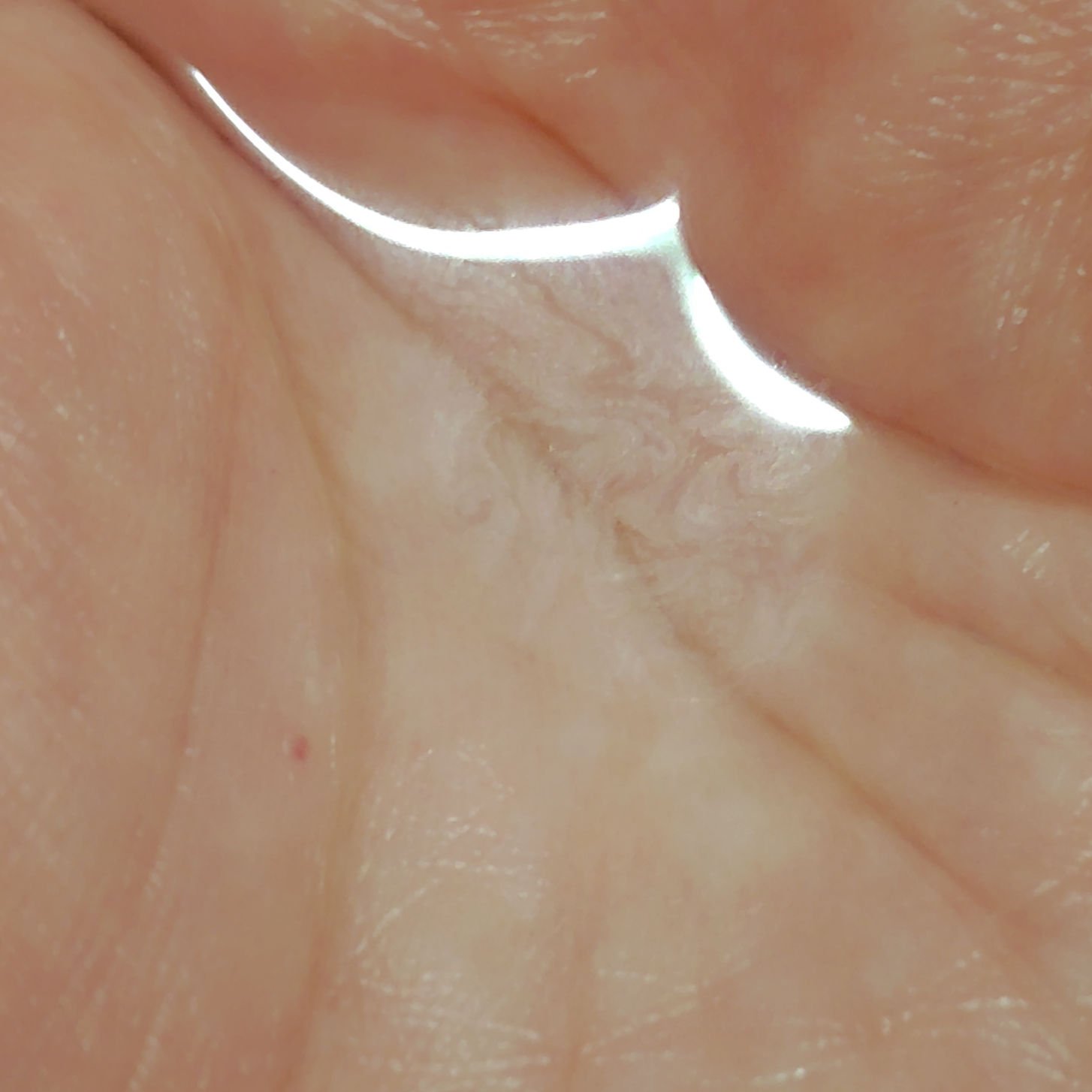 d　プログラム　バランス＆アクネケア　ローション　EX/d プログラム/化粧水を使ったクチコミ（3枚目）