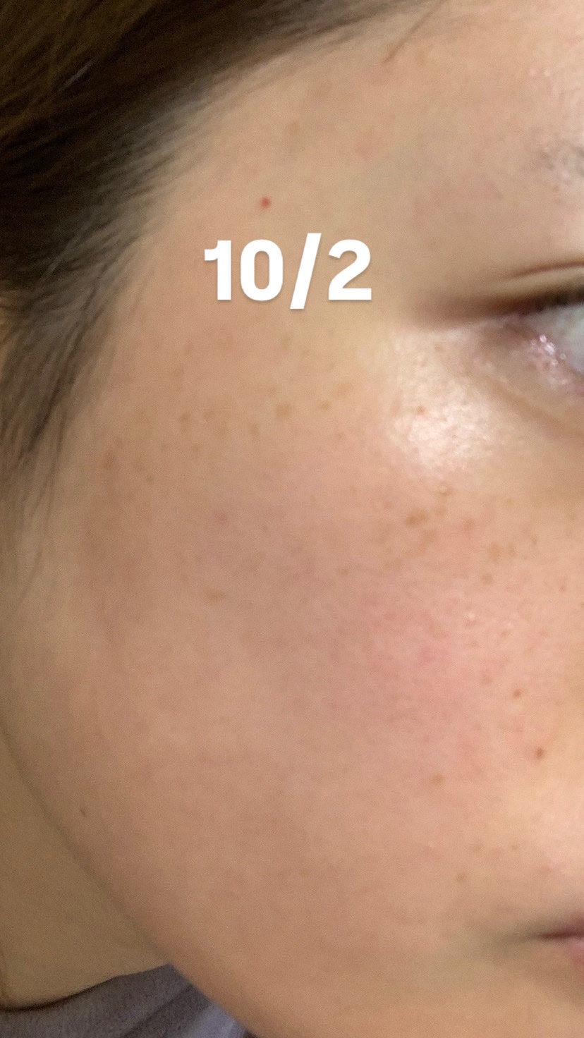 プラスGGベースセラム/プラスキレイ/美容液を使ったクチコミ（2枚目）