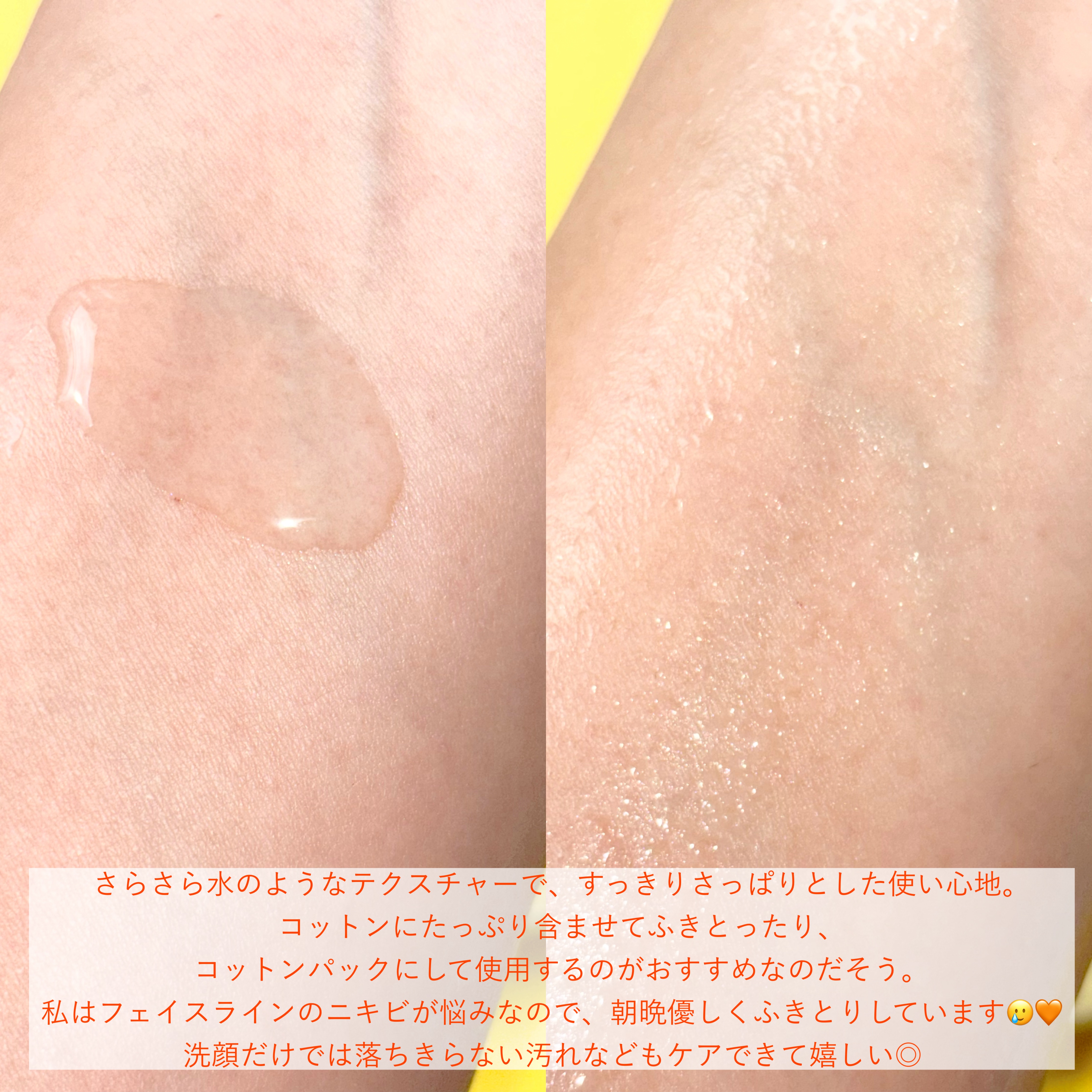 オードムーゲ 薬用ローション（ふきとり化粧水）/オードムーゲ/拭き取り化粧水を使ったクチコミ（3枚目）