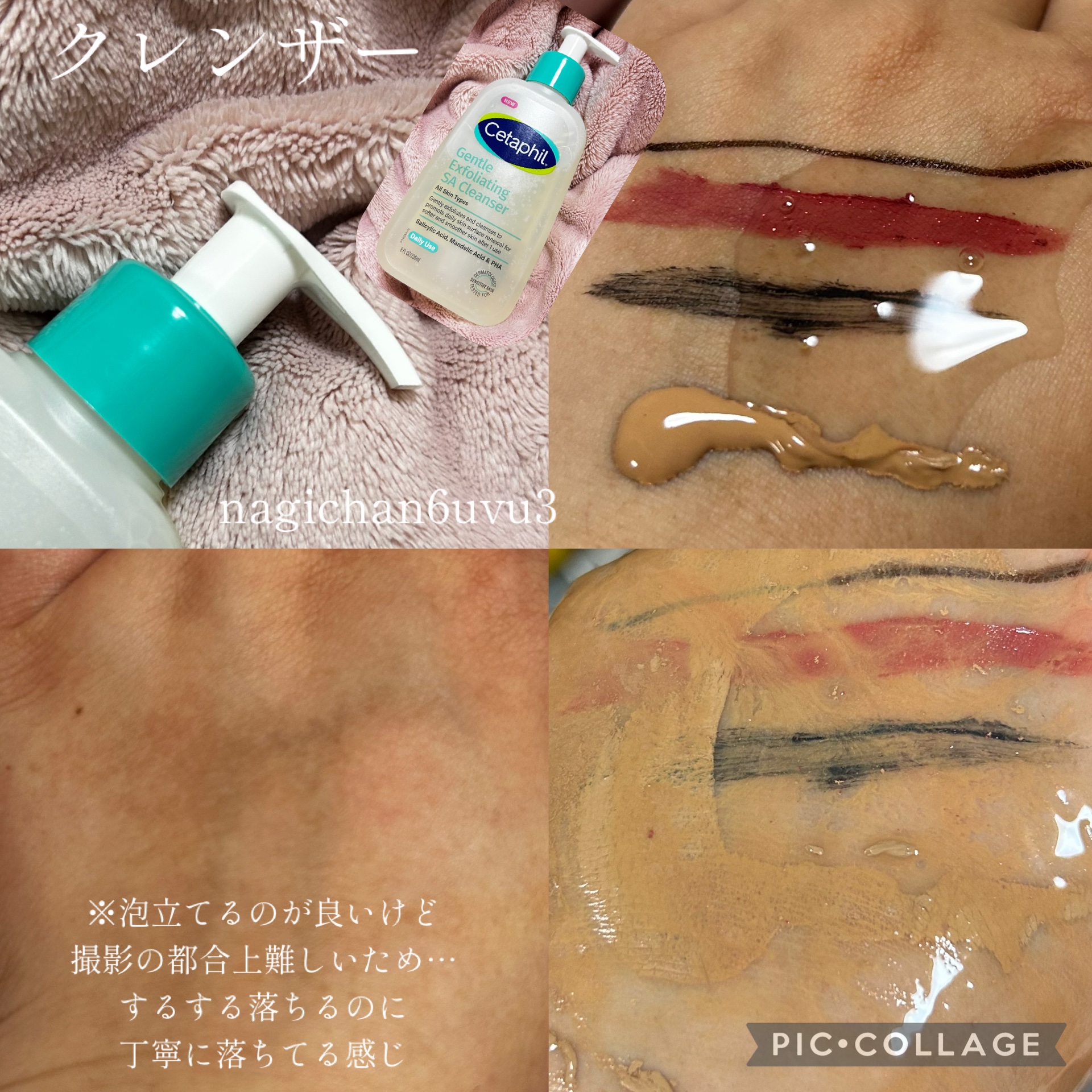 セタフィル　ジェントルSAクレンザー/セタフィル/ピーリングを使ったクチコミ（2枚目）