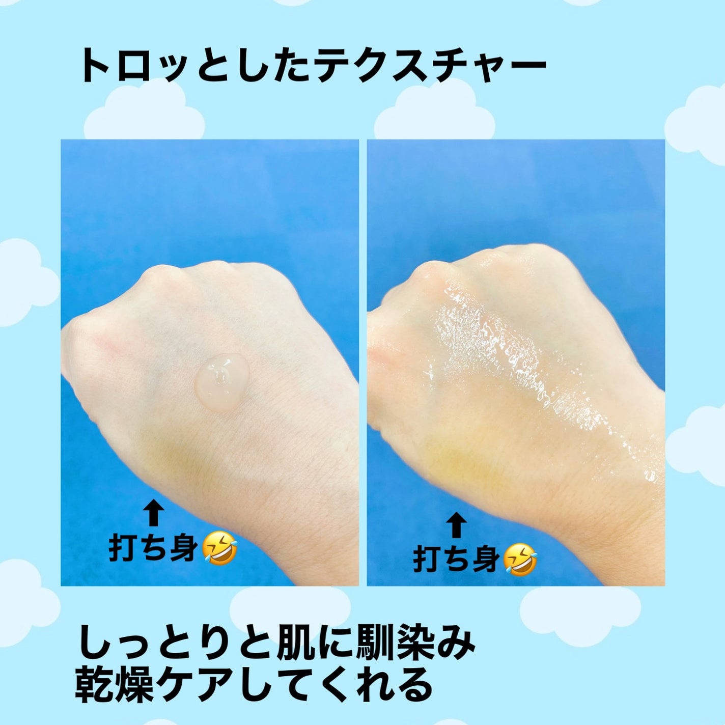 PHセンシティブアンプル/SAM'U/美容液を使ったクチコミ(3枚目)