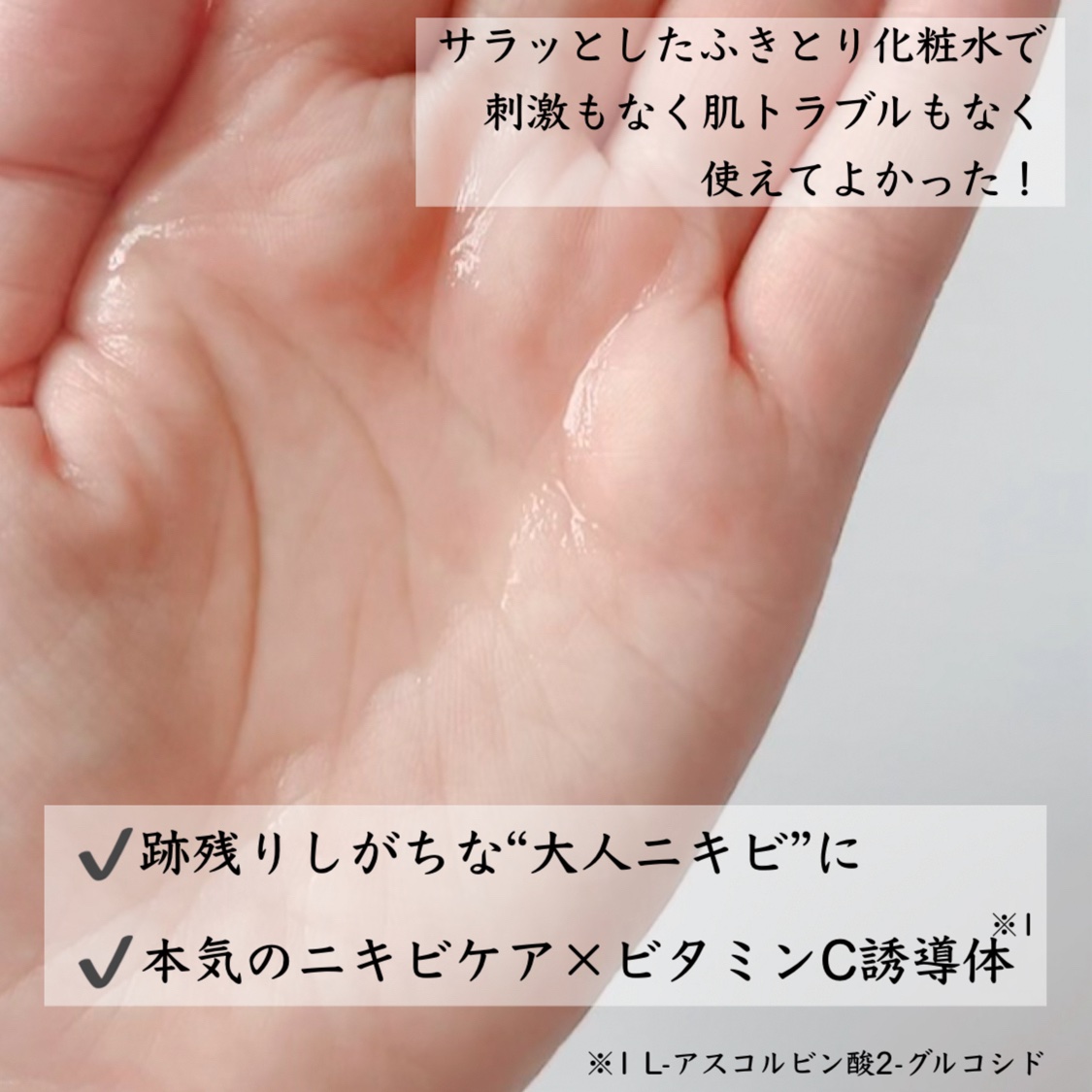 オードムーゲVC 薬用ふきとり化粧水/オードムーゲ/拭き取り化粧水を使ったクチコミ（2枚目）