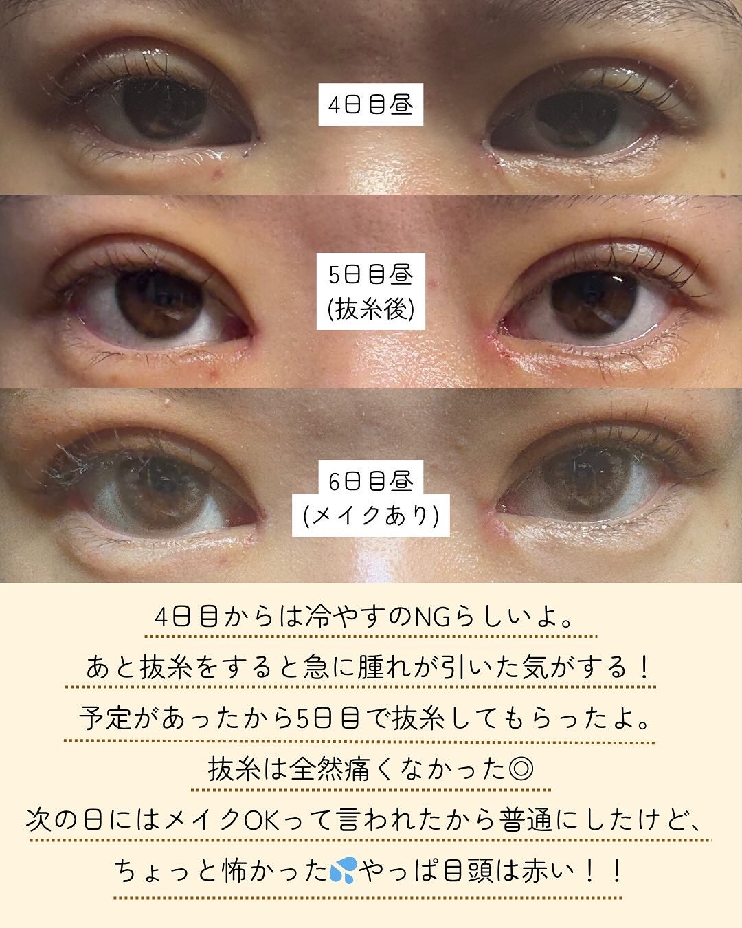 ðððð€ËË on LIPS ãç®é åéïŒäºéåéã¬ãïŒãã£ãšæ°ã«ãªã£ãŠããæè¡ãåããŸãã..ãïŒ5æç®ïŒ