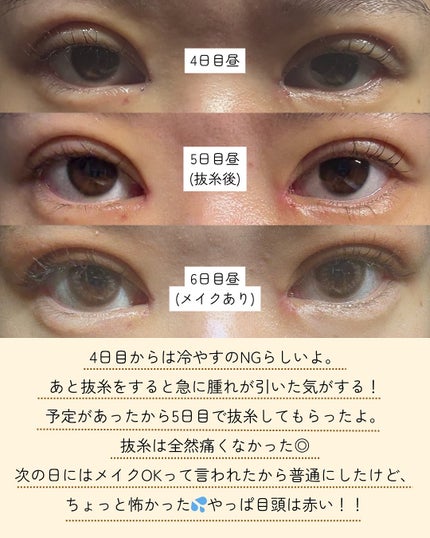 ðððð€ËË on LIPS ãç®é åéïŒäºéåéã¬ãïŒãã£ãšæ°ã«ãªã£ãŠããæè¡ãåããŸãã..ãïŒ5æç®ïŒ