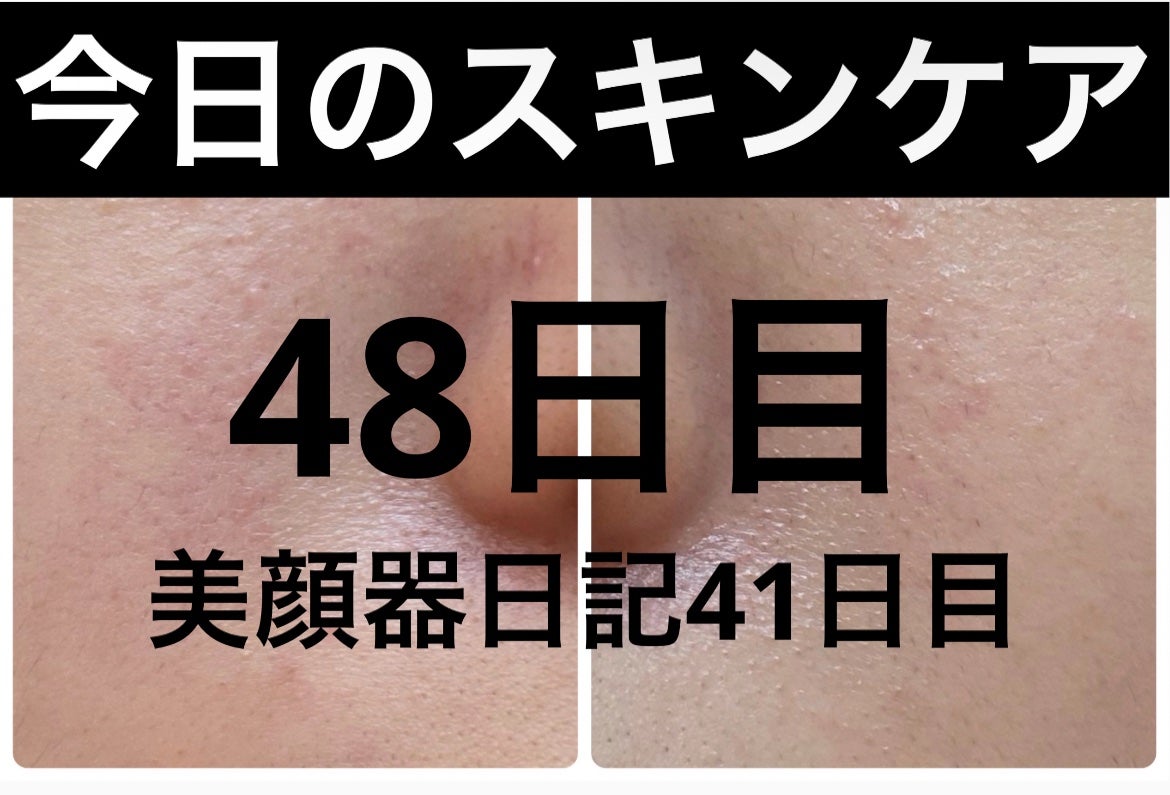 モーニングジェルウォッシュ/ビトレスキン/その他洗顔料を使ったクチコミ(1枚目)