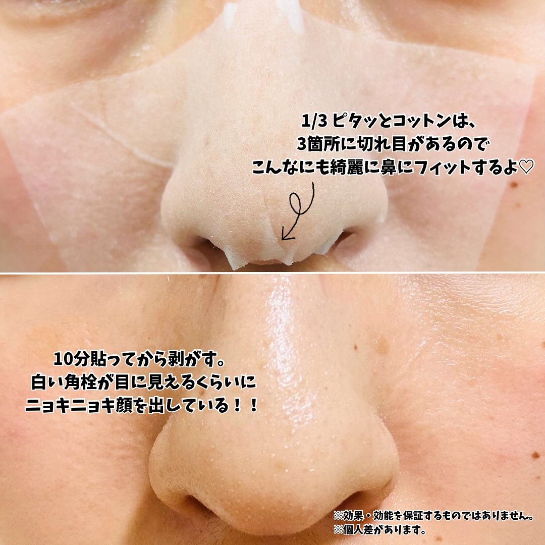 ILSO　スーパーメルティング セバムソフトナー/ilso/化粧水を使ったクチコミ（3枚目）