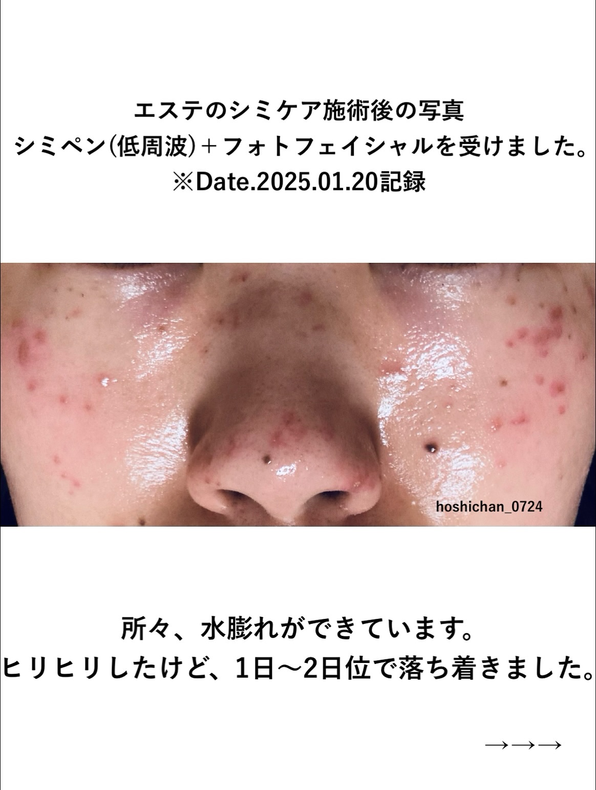 を使ったクチコミ（3枚目）