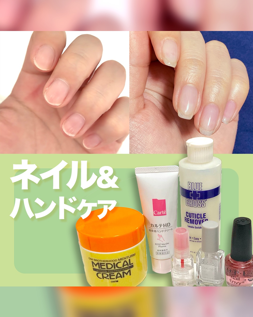 メディカルクリームG（薬用クリームG）/メンターム/ハンドクリームを使ったクチコミ（1枚目）