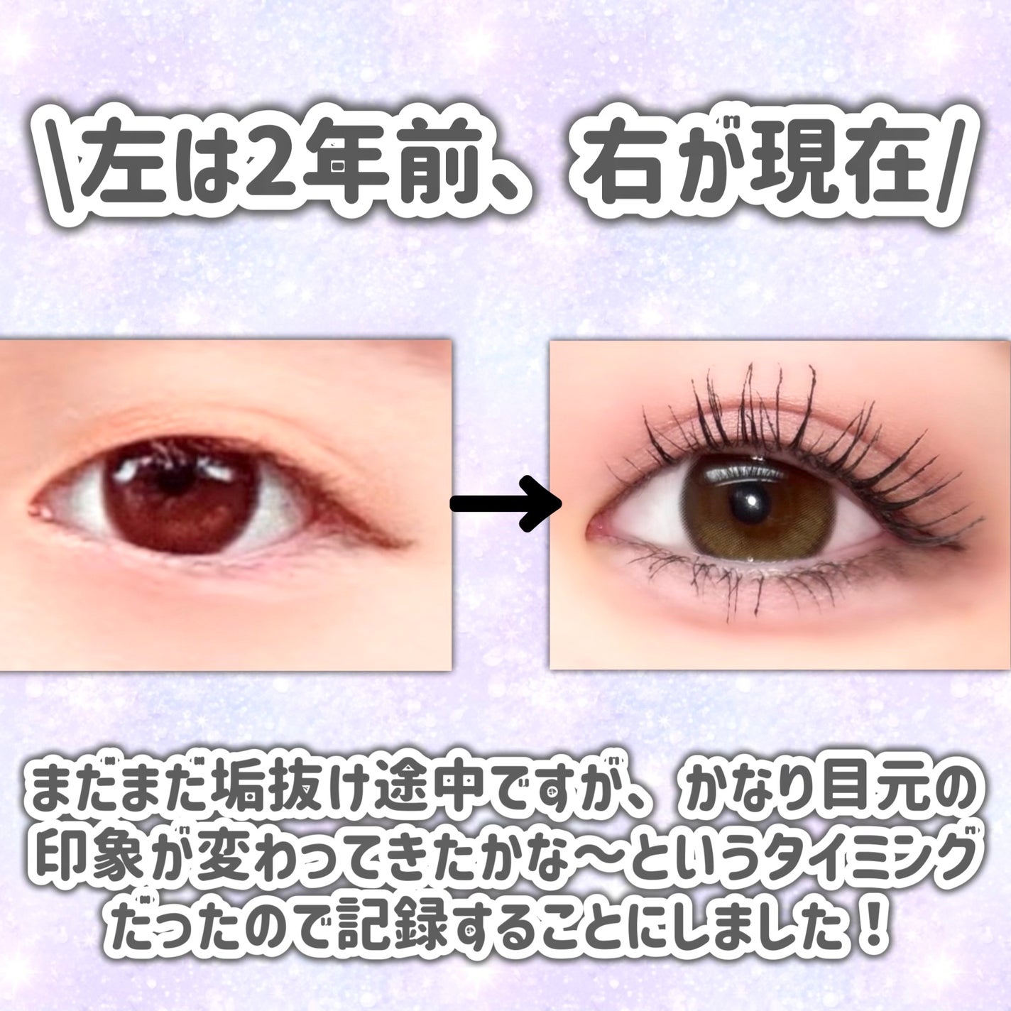 EMAKED(エマーキット)/水橋保寿堂製薬/まつげ美容液を使ったクチコミ(2枚目)