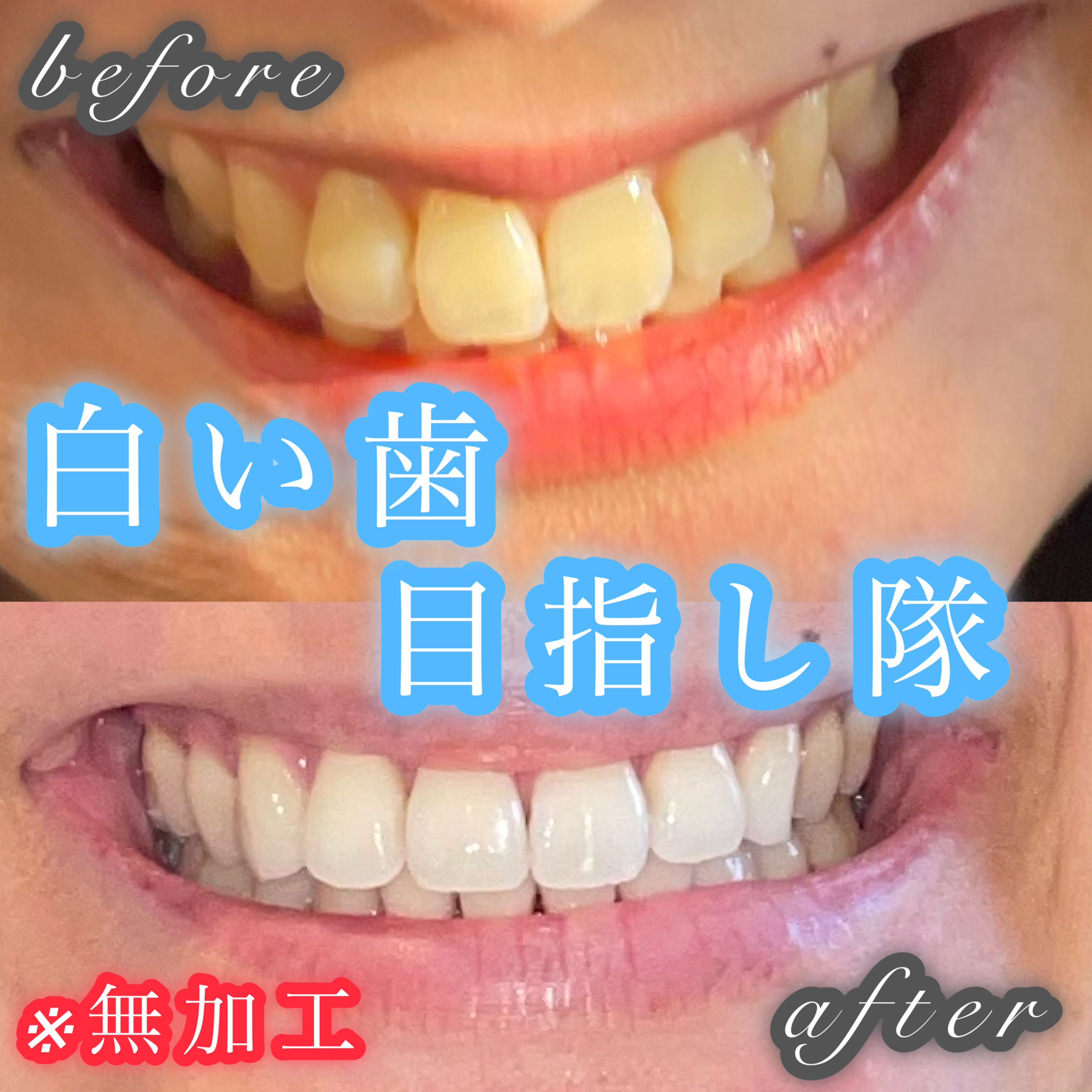 NONIOマウスウォッシュ/NONIO/マウスウォッシュ・スプレーを使ったクチコミ（1枚目）