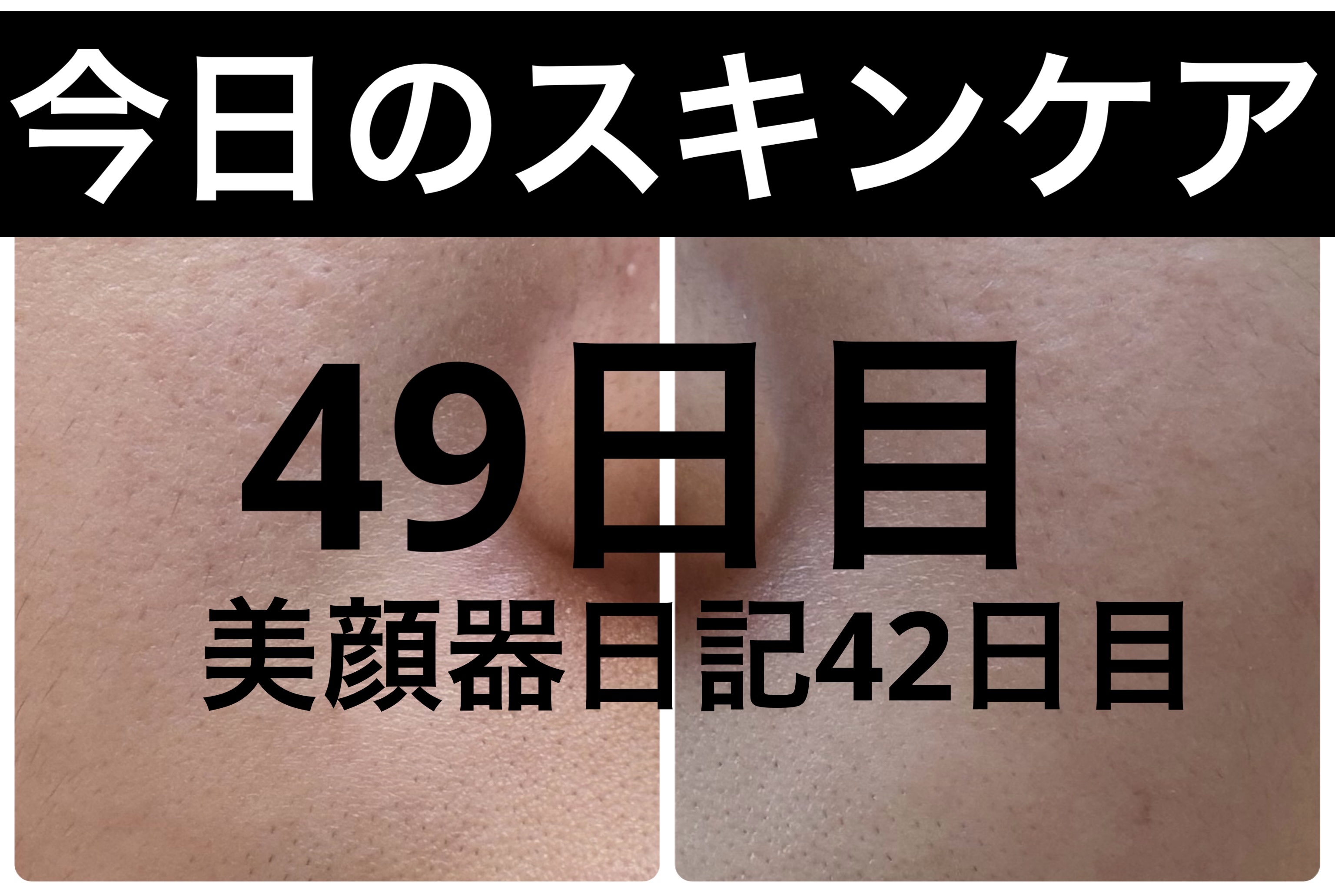 薬用雪肌精 ブライトニング クレンジング オイル[医薬部外品]/雪肌精/オイルクレンジングを使ったクチコミ（1枚目）