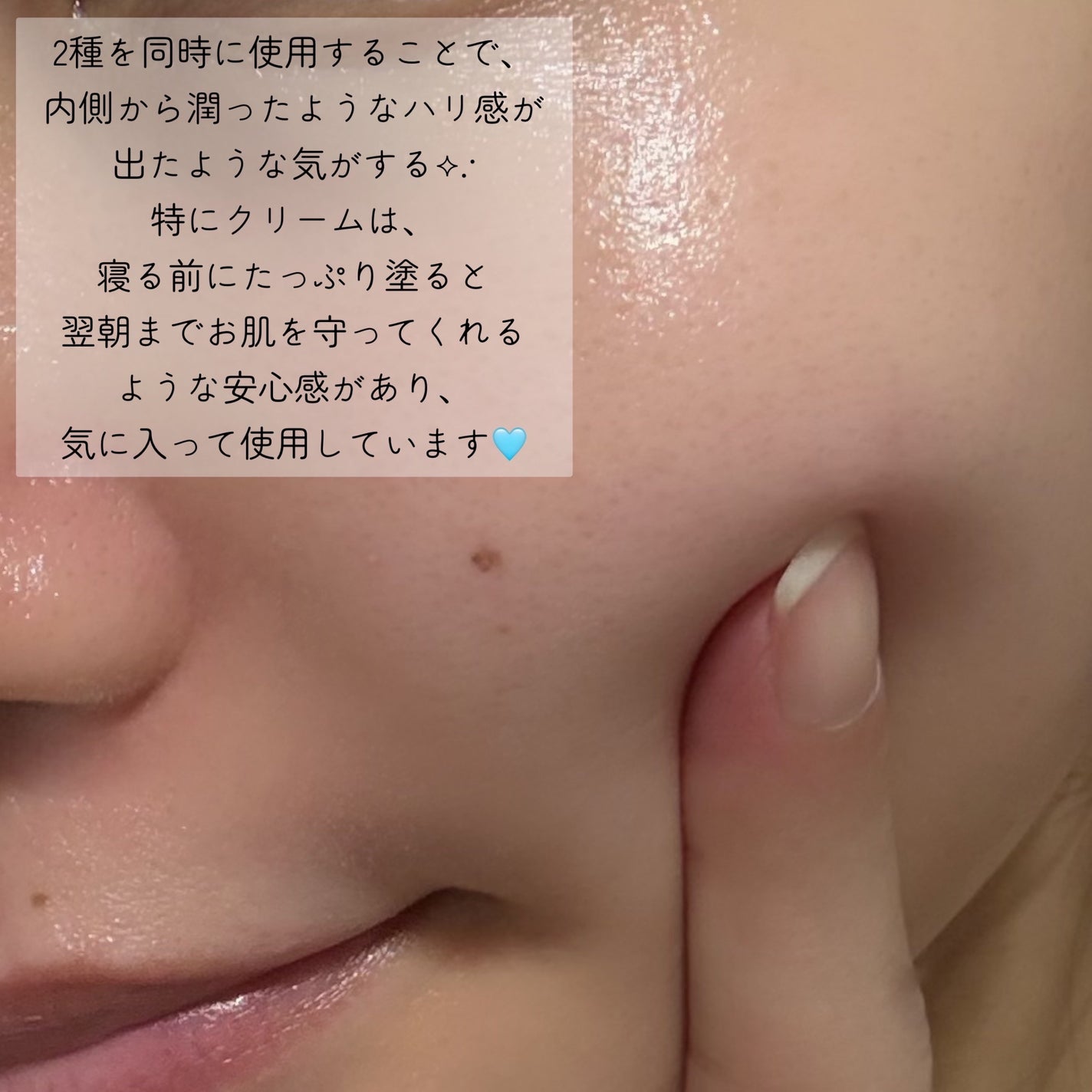 ブラックスネイル クリーム/Dr.G/フェイスクリームを使ったクチコミ(3枚目)