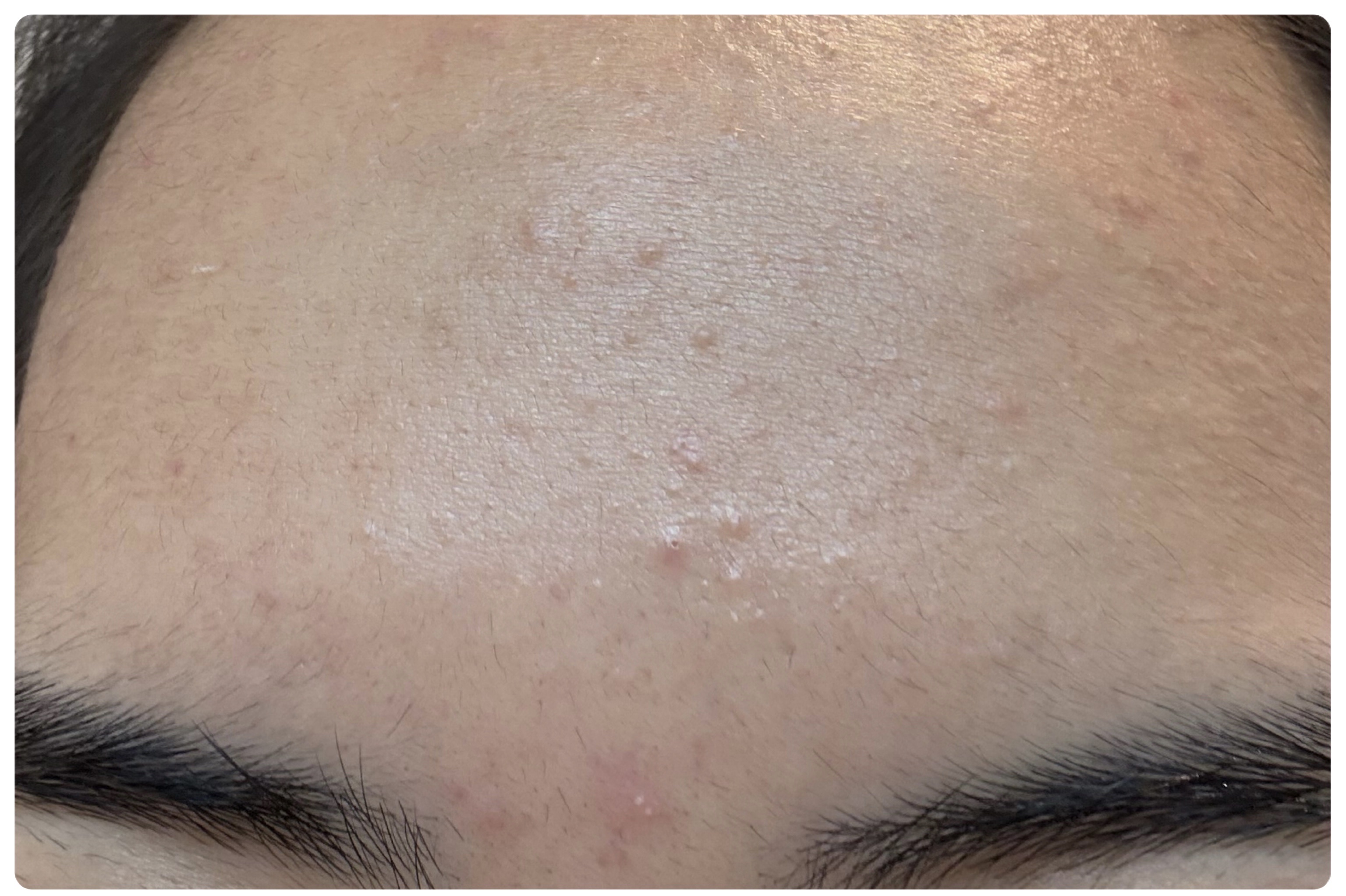 AGE-R ブースタープロ/MEDICUBE/美顔器・マッサージを使ったクチコミ（3枚目）