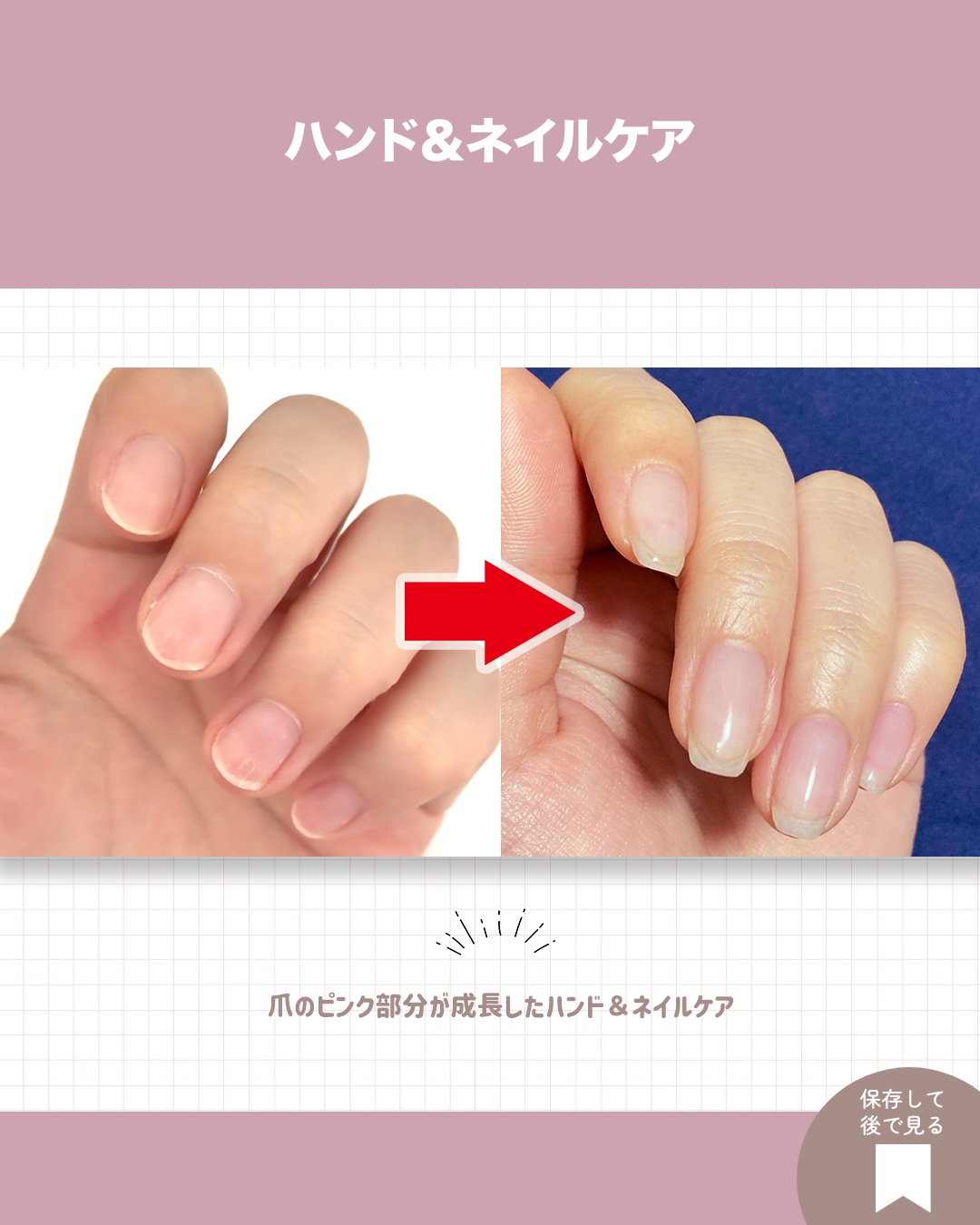 メディカルクリームG（薬用クリームG）/メンターム/ハンドクリームを使ったクチコミ（2枚目）