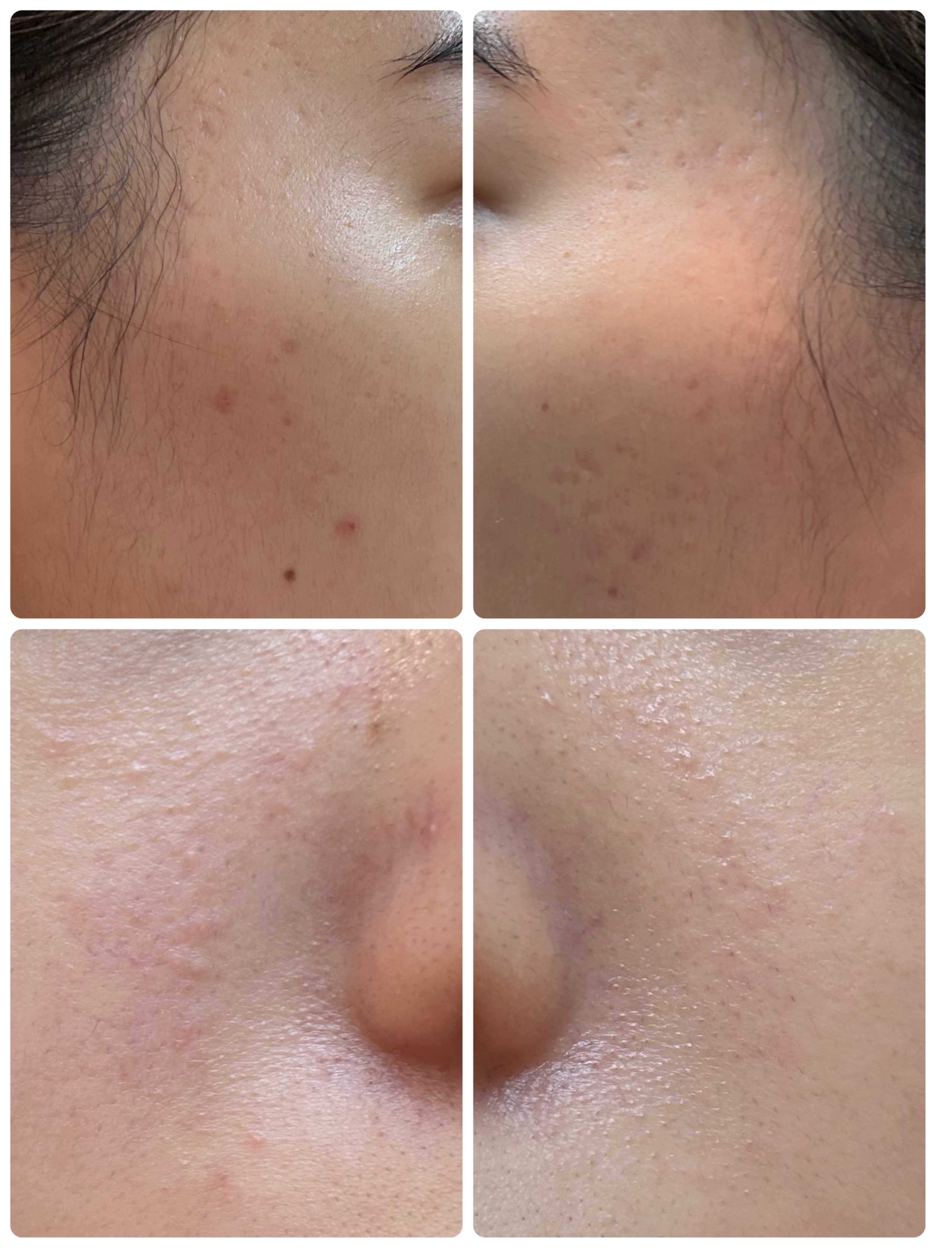 AGE-R ブースタープロ/MEDICUBE/美顔器・マッサージを使ったクチコミ（2枚目）