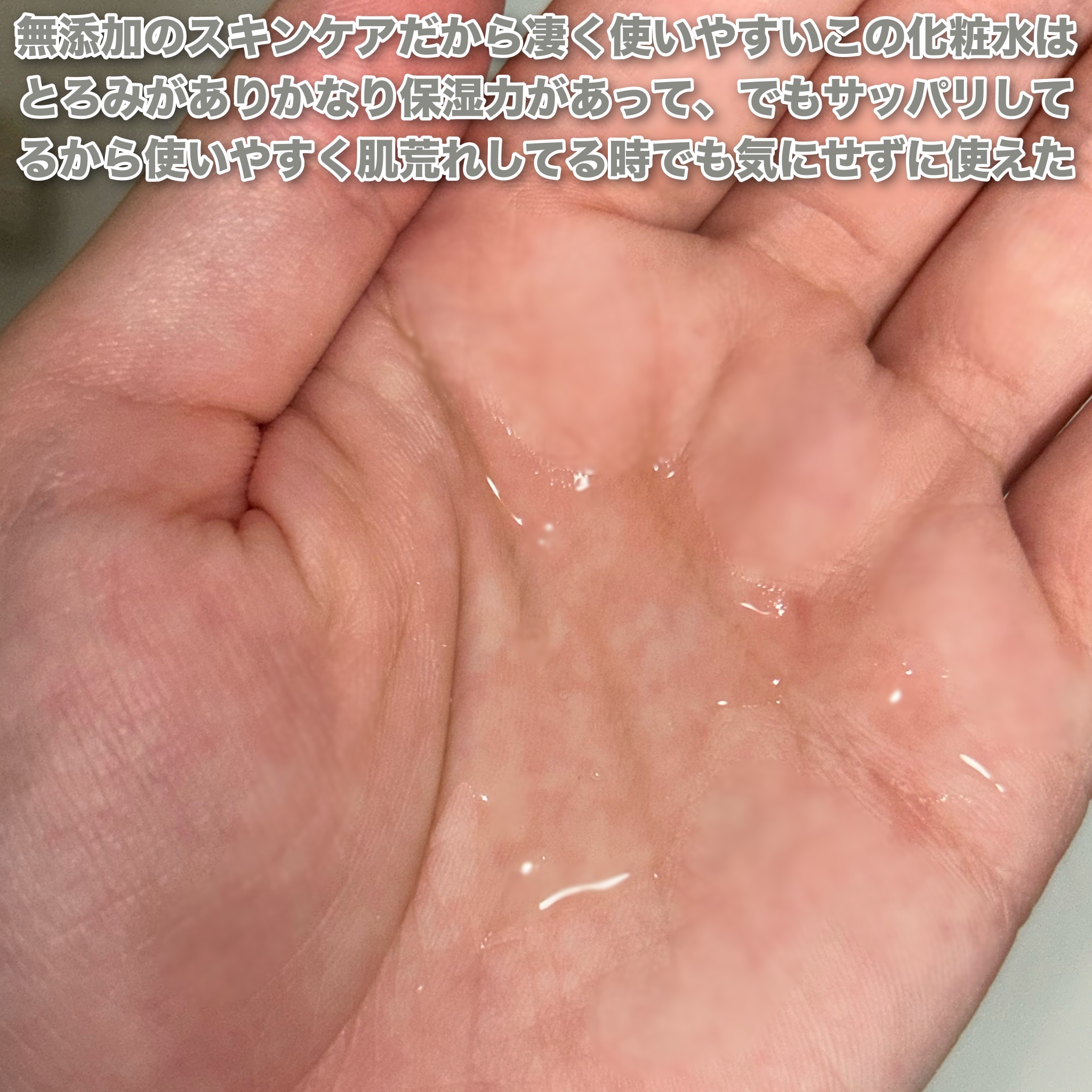 モイストボタニカル オールインワンジェルR/unlabel/オールインワン化粧品を使ったクチコミ（2枚目）