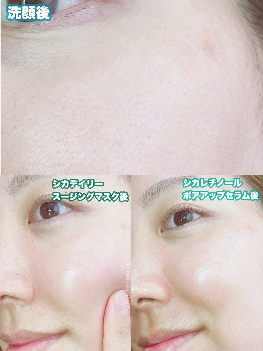 CICA デイリースージングマスク/VT/シートマスク・パックを使ったクチコミ(4枚目)