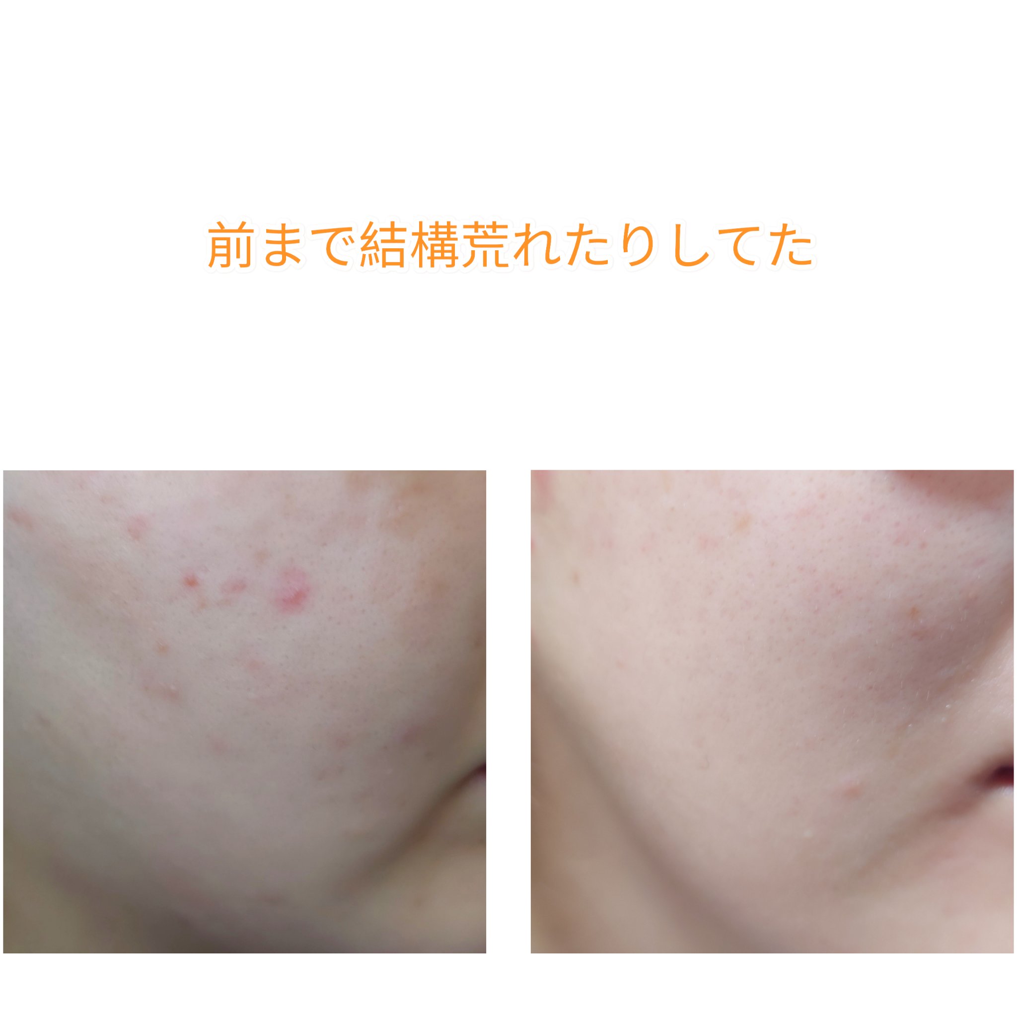 バデカシルDクリーム/23years old/フェイスクリームを使ったクチコミ（2枚目）