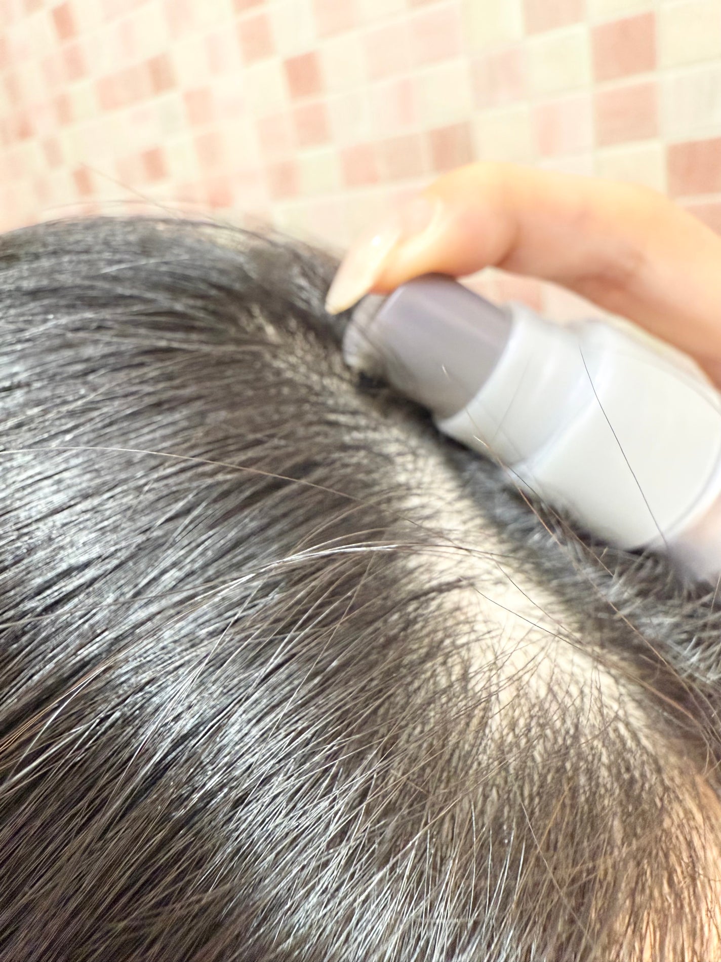 アデノバイタル スカルプ パワーショット/サブリミック/頭皮ローションを使ったクチコミ(3枚目)