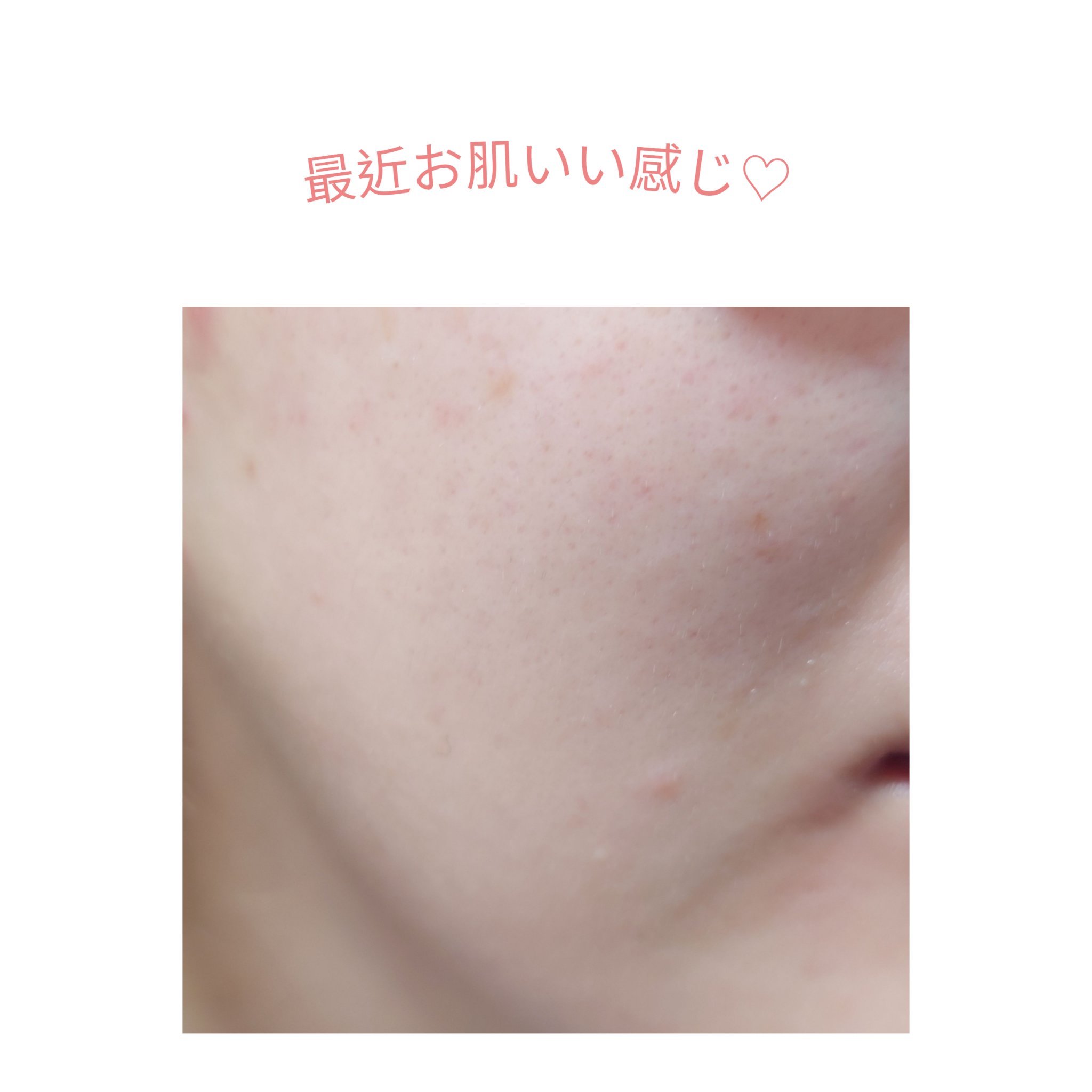 バデカシルDクリーム/23years old/フェイスクリームを使ったクチコミ（1枚目）