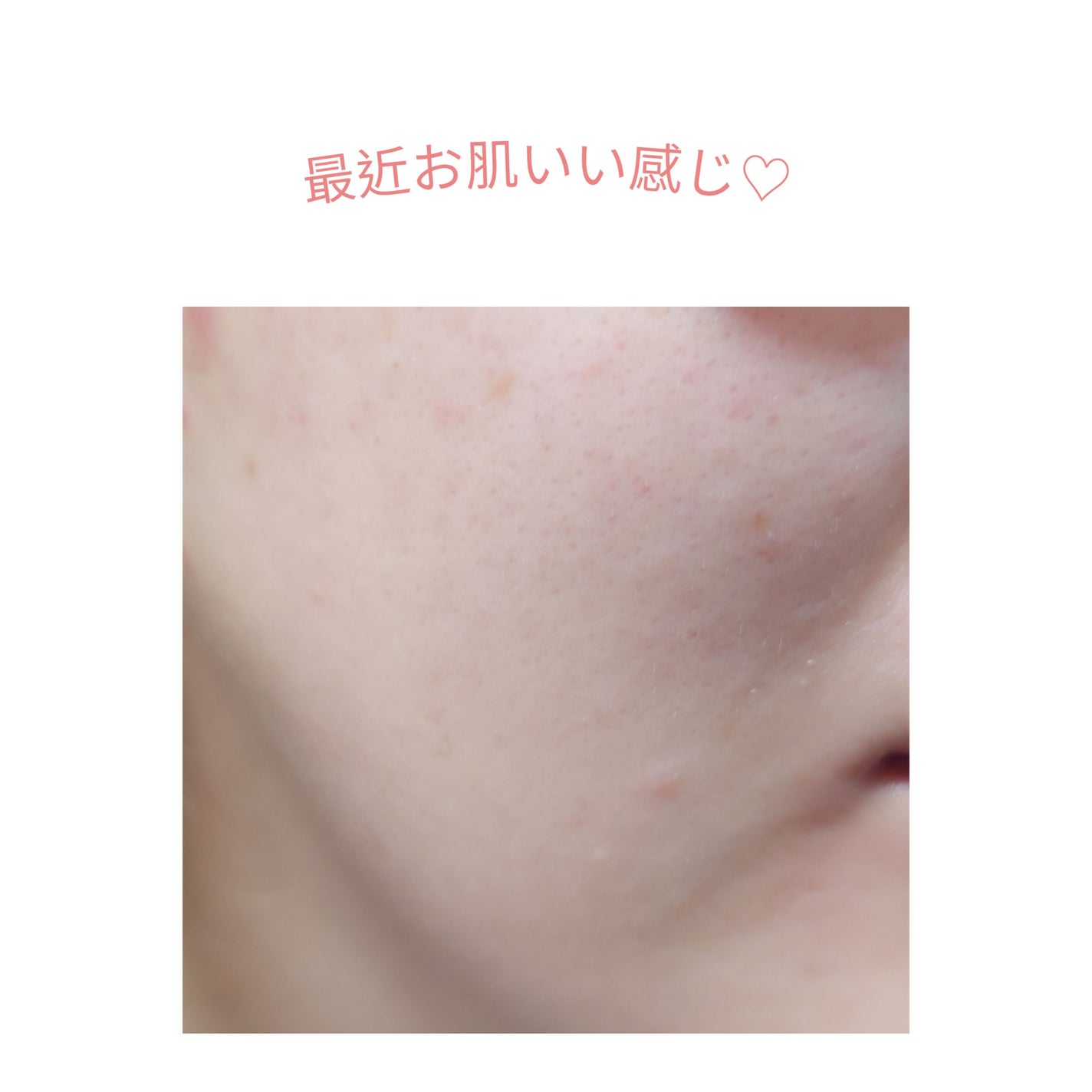 バデカシルDクリーム/23years old/フェイスクリームを使ったクチコミ(1枚目)