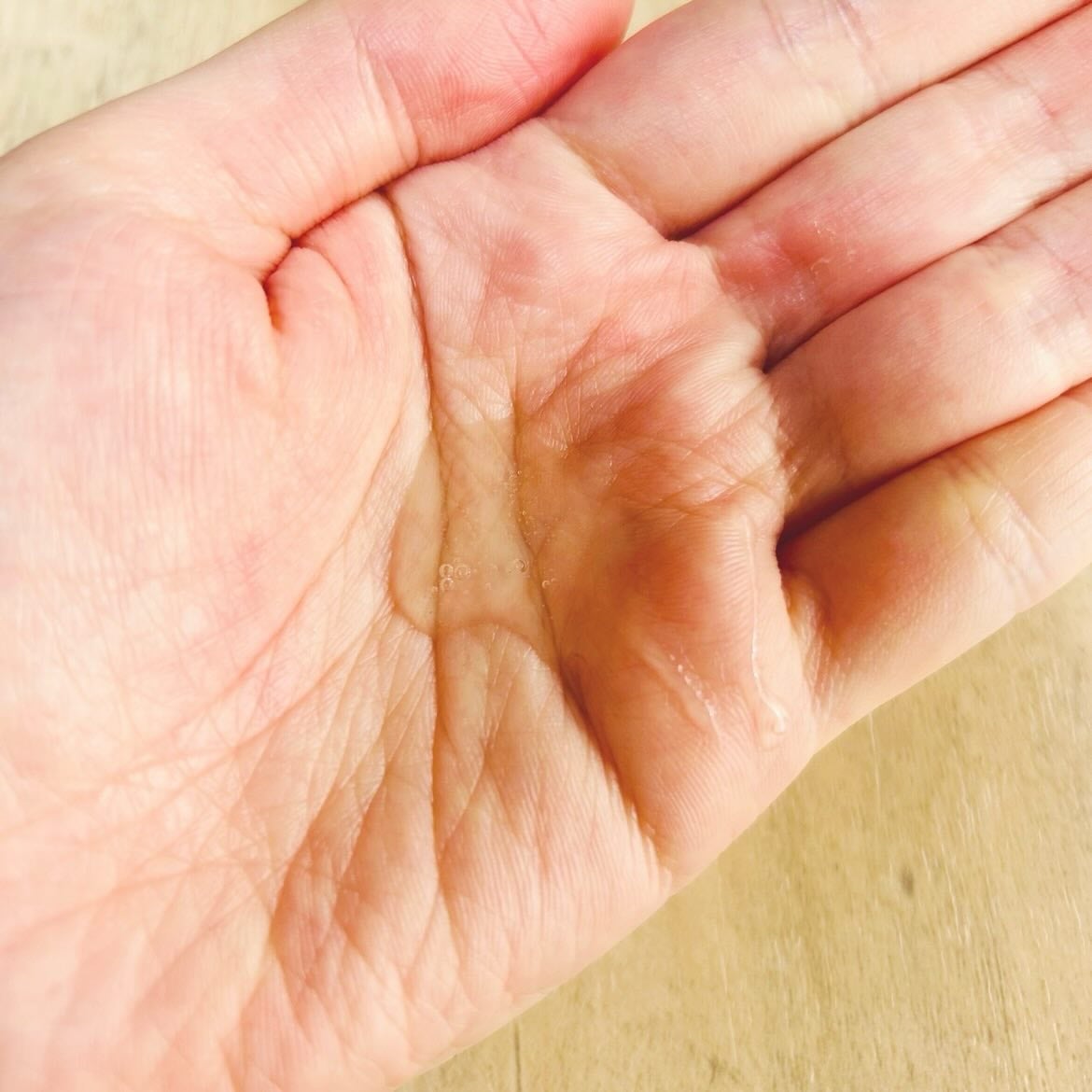 セタフィル ジェントルSAクレンザー/セタフィル/ピーリングを使ったクチコミ(3枚目)