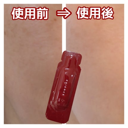 C×AZ ダーマインショット200/ESIENCE/美容液を使ったクチコミ(5枚目)