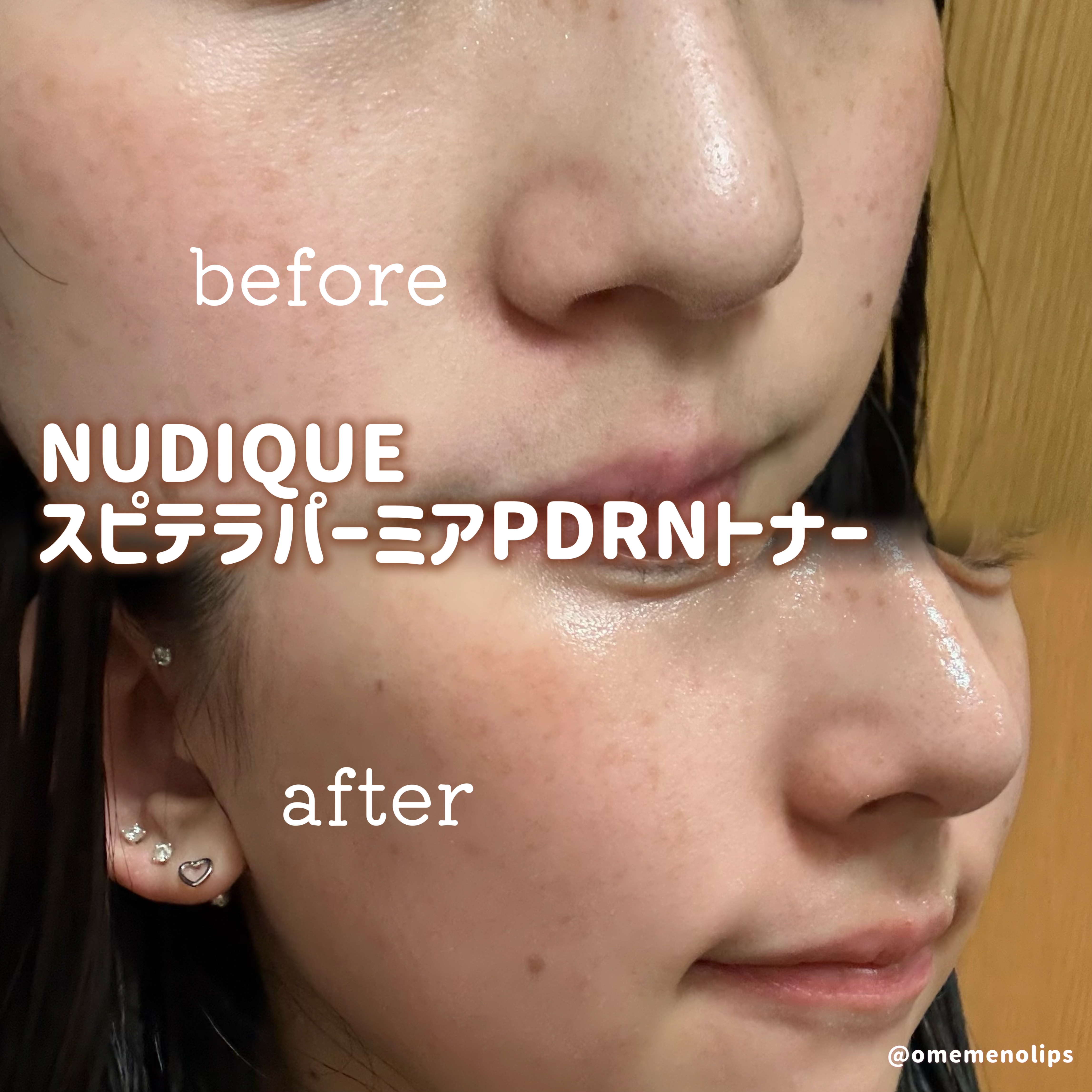 スピテラパーミアPDRNトナー/NUDIQUE/化粧水を使ったクチコミ（3枚目）